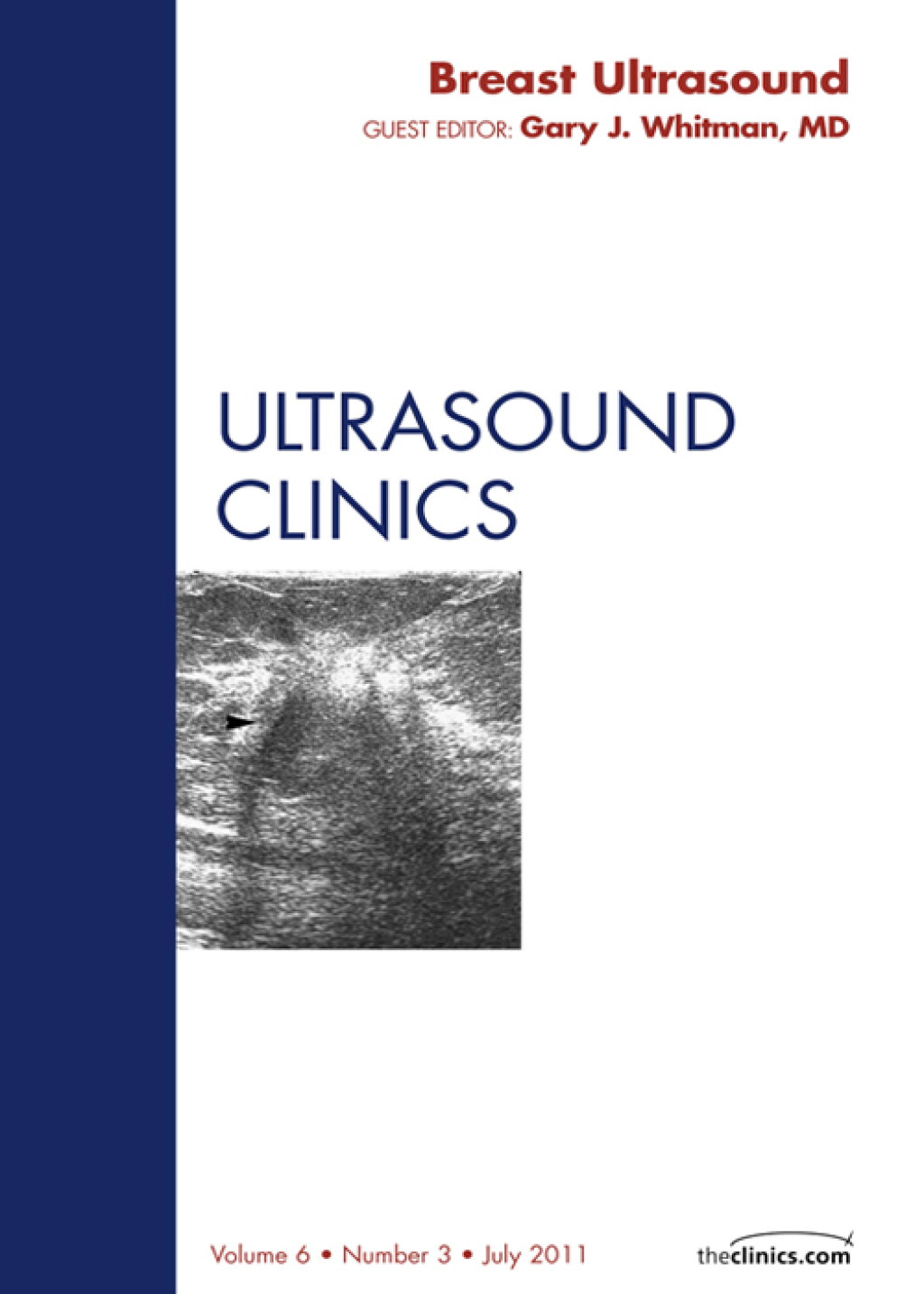 Breast Ultrasound, An Issue of Ultrasound Clinics  â€“ PDF/EPUB Version Downloadable