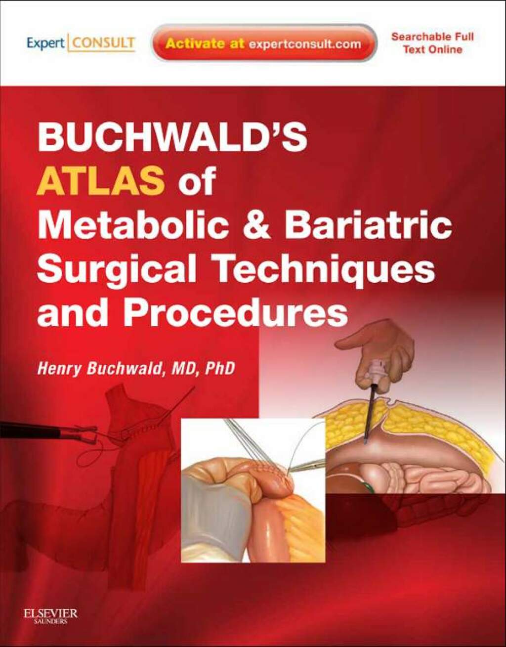 Buchwald's Atlas of Metabolic & Bariatric Surgical Techniques and Procedures - Electronic 1st Edition â€“ PDF/EPUB Version Downloadable