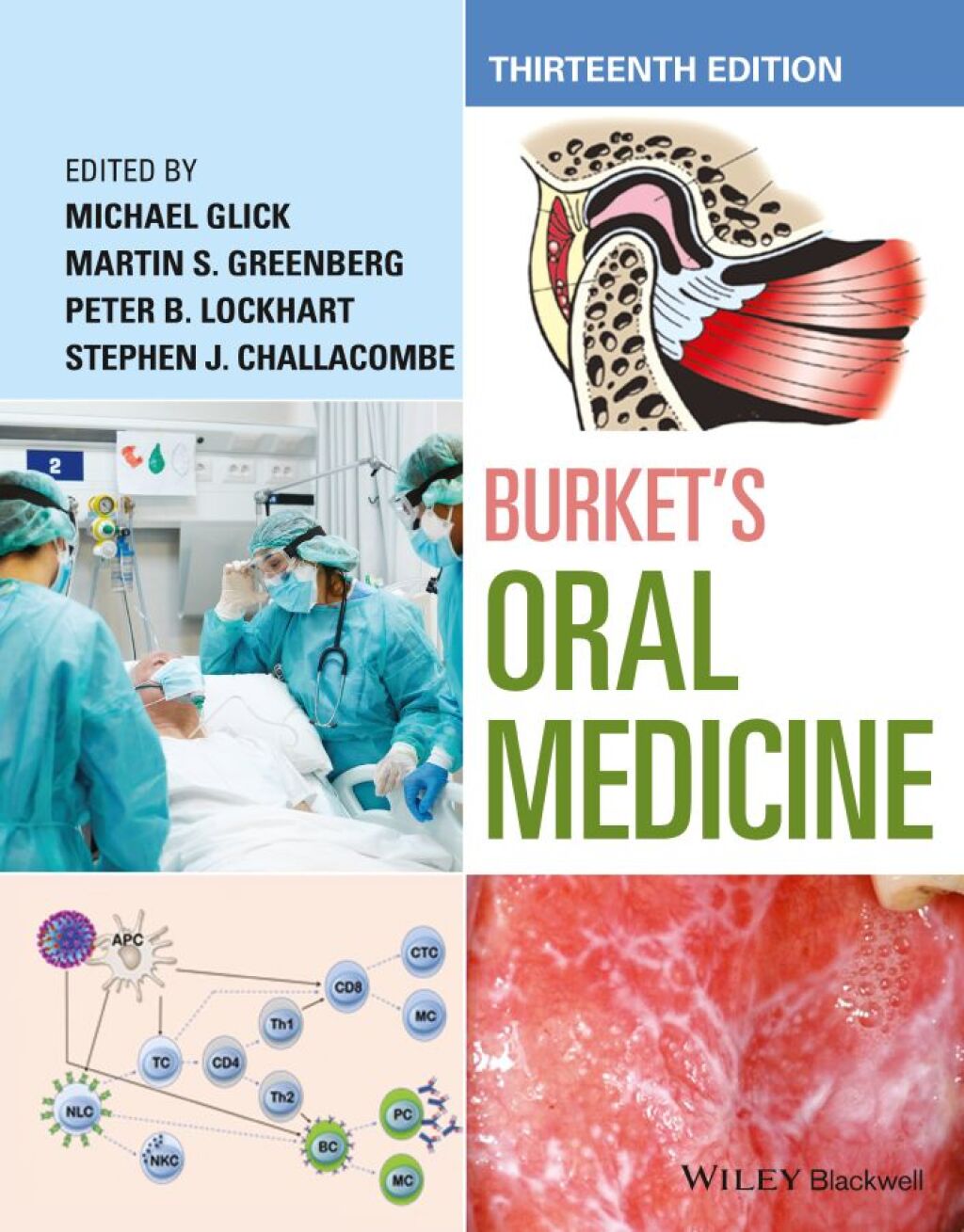 Burket's Oral Medicine 13th Edition â€“ PDF/EPUB Version Downloadable