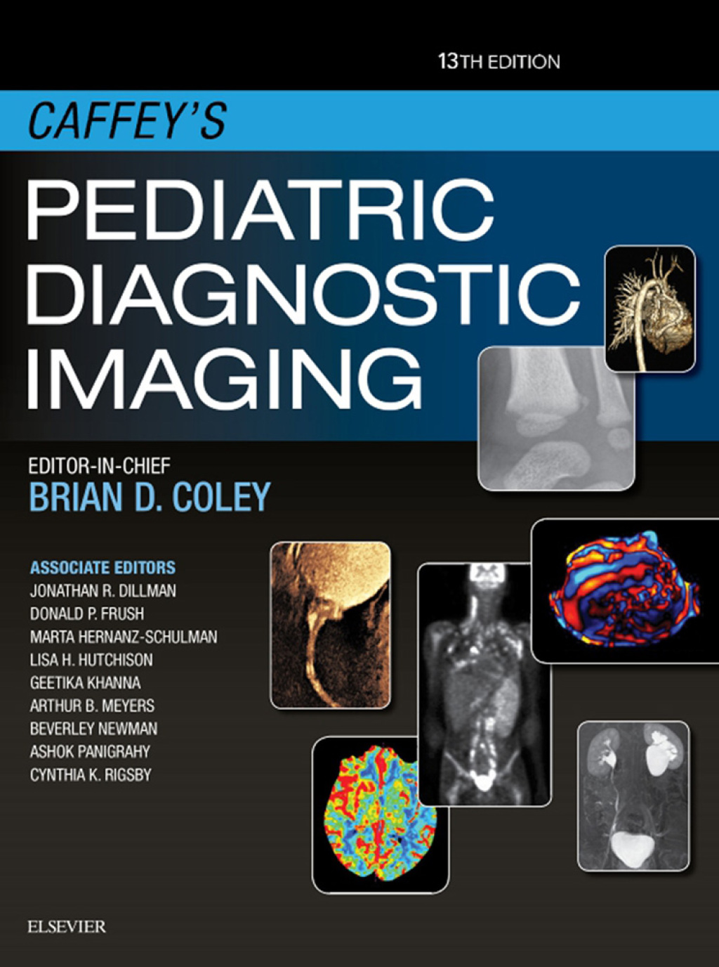 Caffey's Pediatric Diagnostic Imaging 13th Edition â€“ PDF/EPUB Version Downloadable