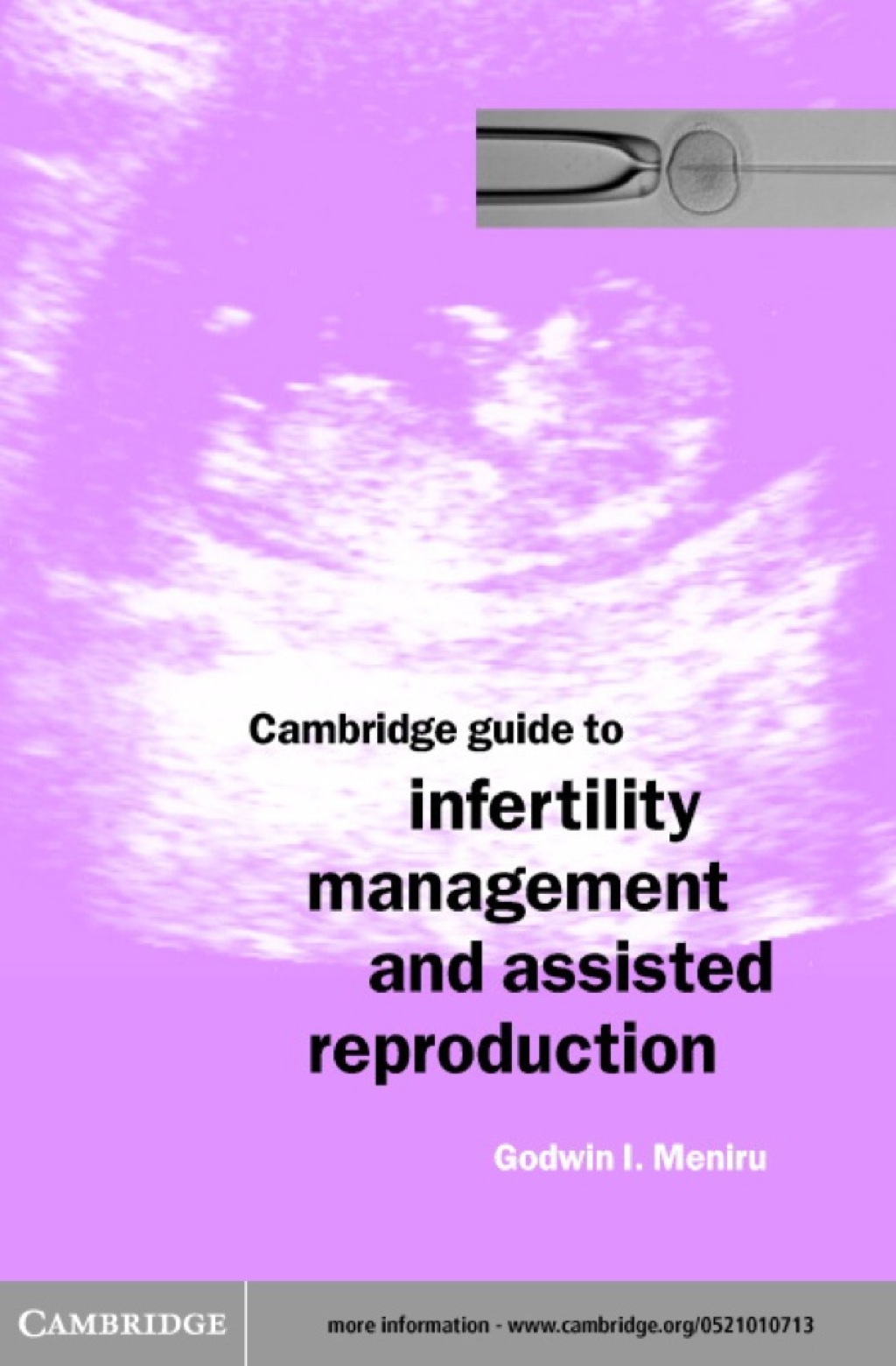 Cambridge Guide to Infertility Management and Assisted Reproduction 1st Edition â€“ PDF/EPUB Version Downloadable
