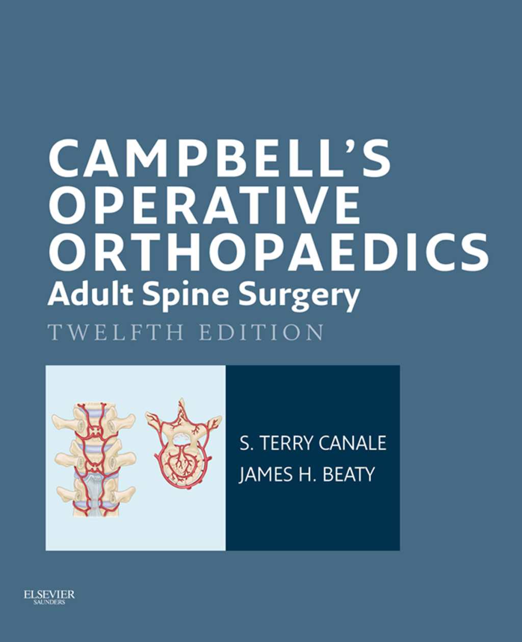Campbell's Operative Orthopaedics: Adult Spine Surgery 12th Edition â€“ PDF/EPUB Version Downloadable