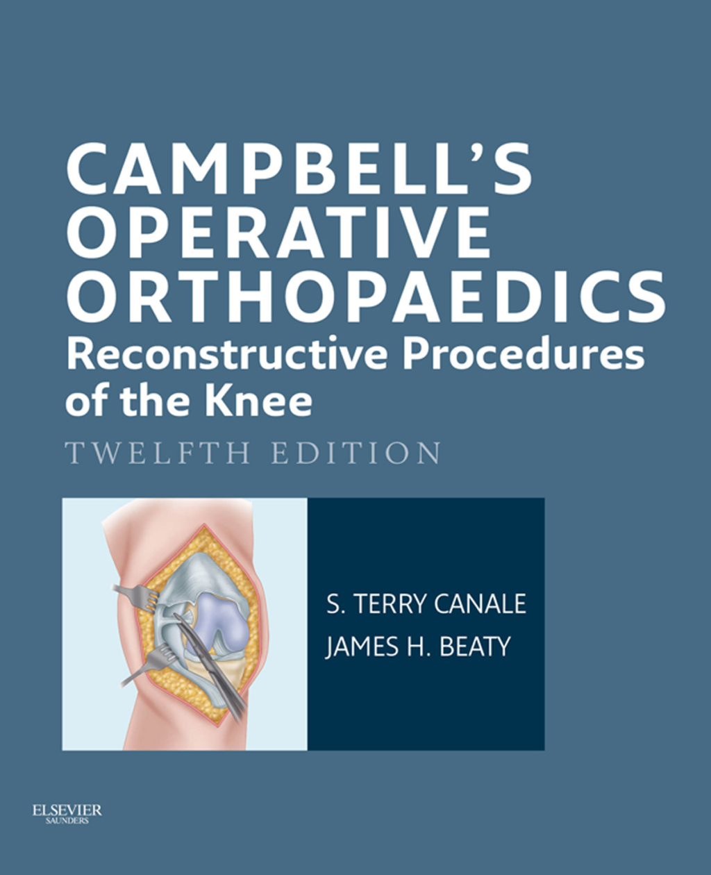Campbell's Operative Orthopaedics: Reconstructive Procedures of the Knee 12th Edition â€“ PDF/EPUB Version Downloadable