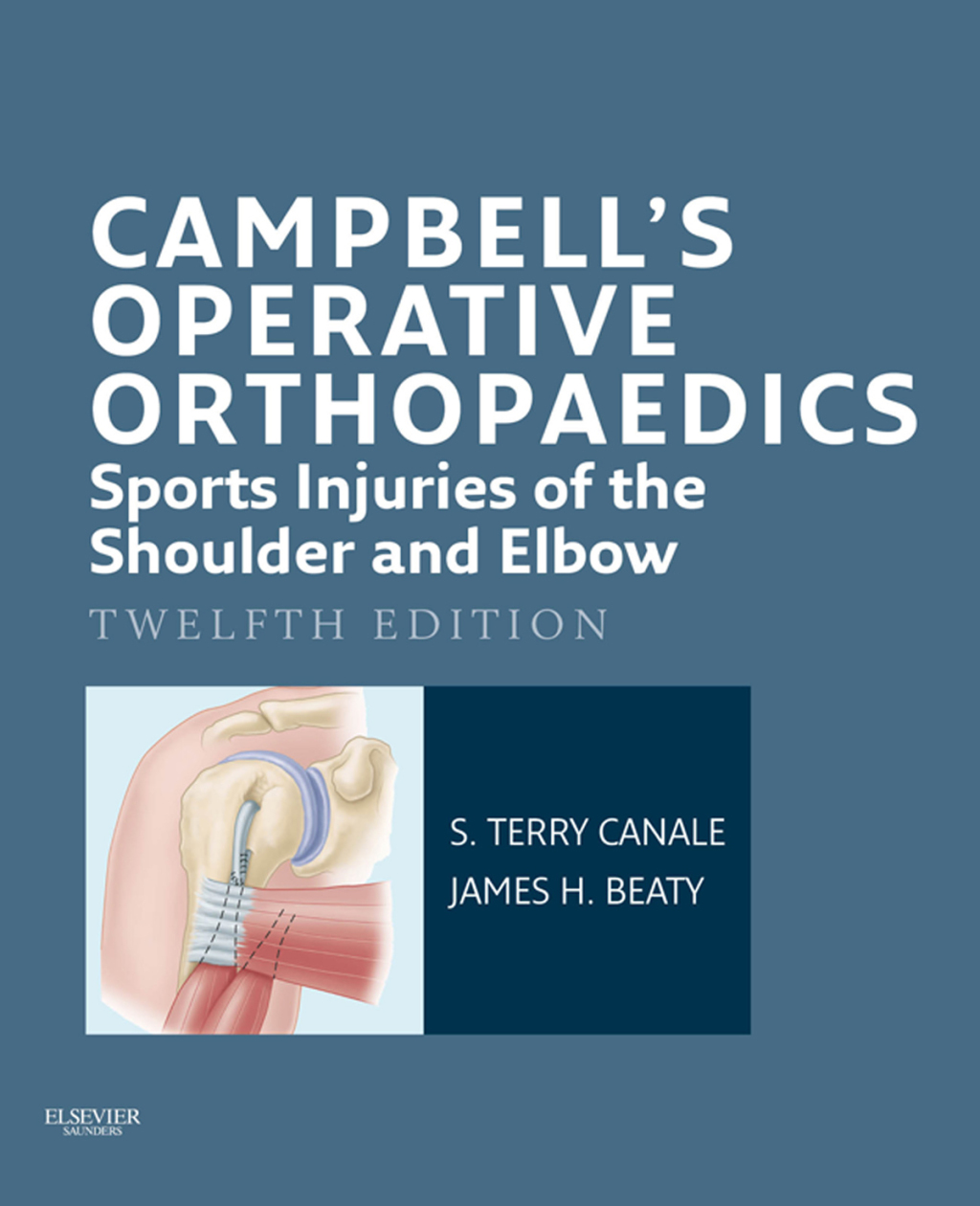 Campbell's Operative Orthopaedics: Sports Injuries of the Shoulder and Elbow 12th Edition â€“ PDF/EPUB Version Downloadable