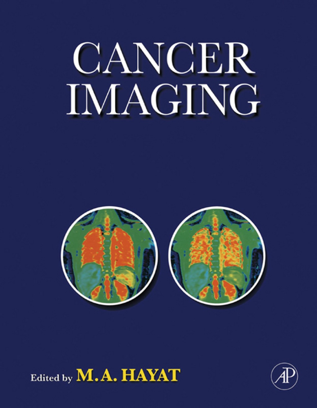 Cancer Imaging â€“ PDF/EPUB Version Downloadable