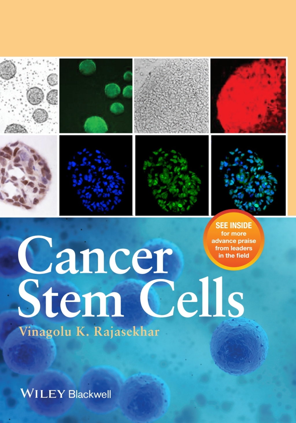 Cancer Stem Cells 1st Edition – PDF/EPUB Version Downloadable Cancer Stem Cells 1st Edition – PDF/EPUB Version Downloadable - Image 1