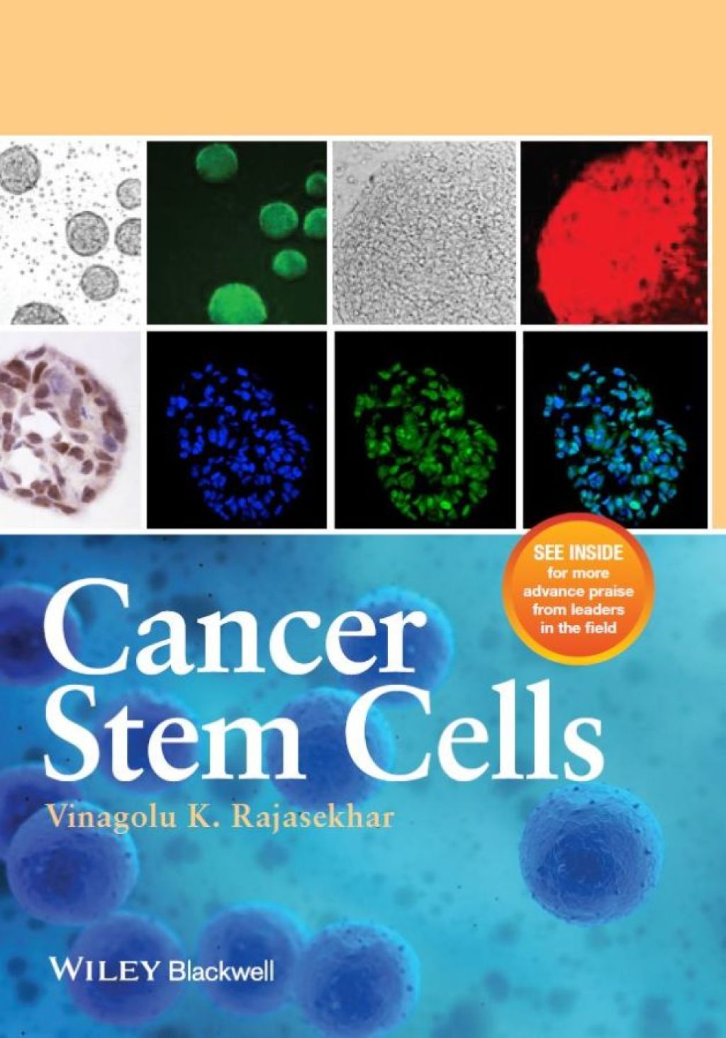 Cancer Stem Cells 1st Edition â€“ PDF/EPUB Version Downloadable