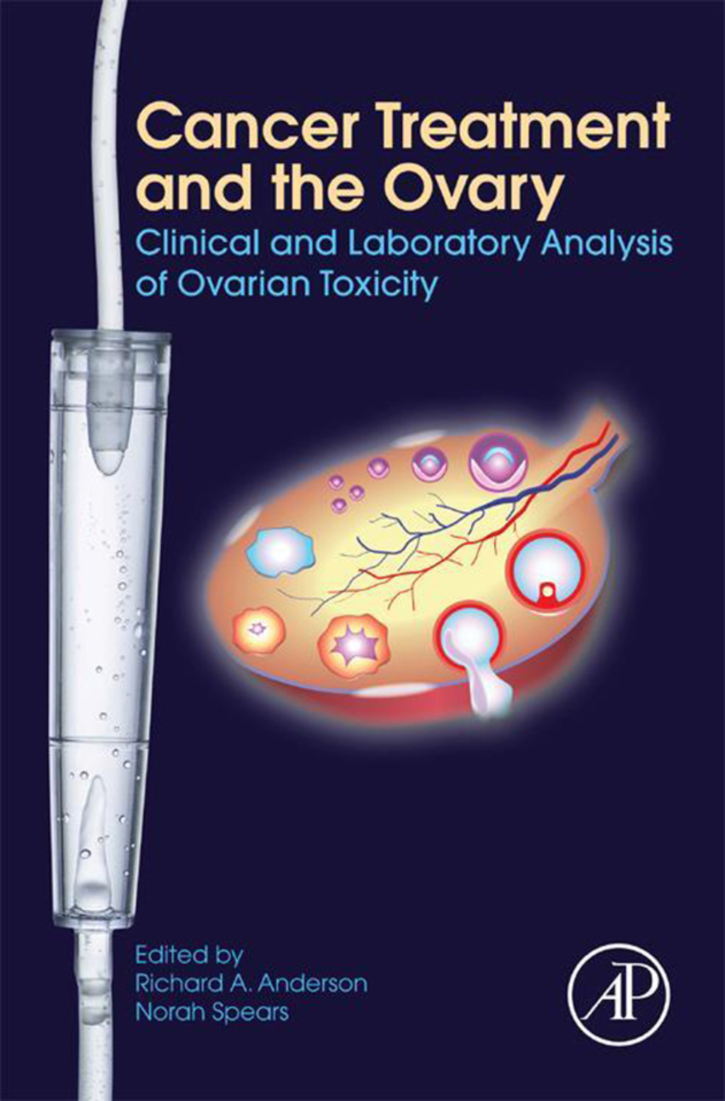 Cancer Treatment and the Ovary: Clinical and Laboratory Analysis of Ovarian Toxicity  â€“ PDF/EPUB Version Downloadable