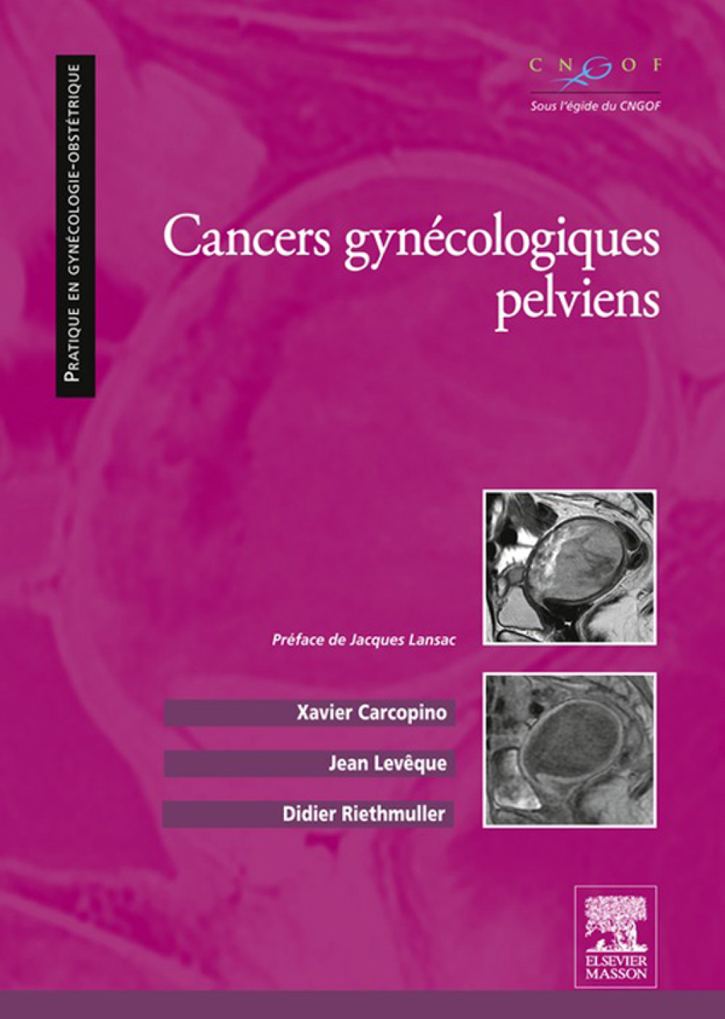 Cancers gynÃ©cologiques pelviens  â€“ PDF/EPUB Version Downloadable