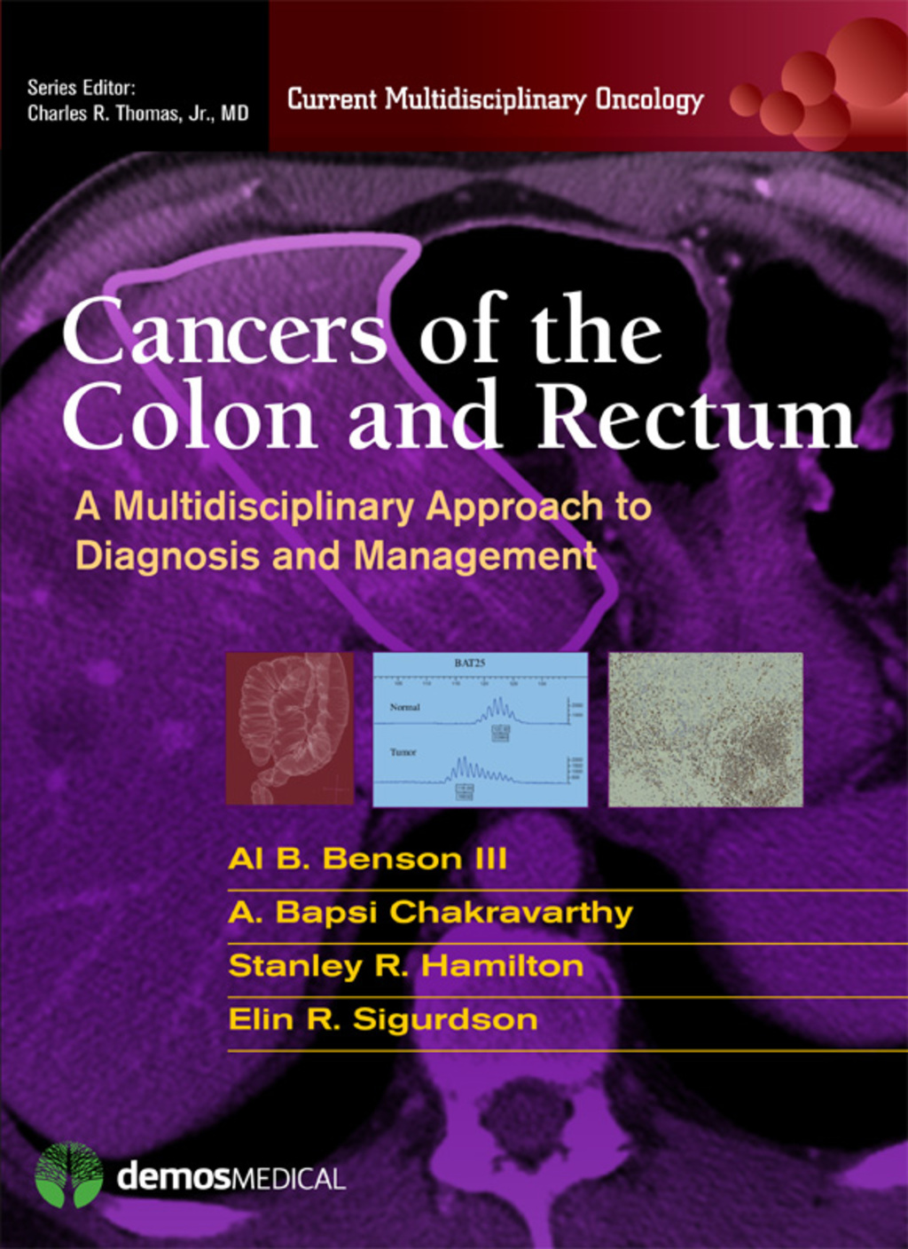 Cancers of the Colon and Rectum A Multidisciplinary Approach to Diagnosis and Management 1st Edition â€“ PDF/EPUB Version Downloadable