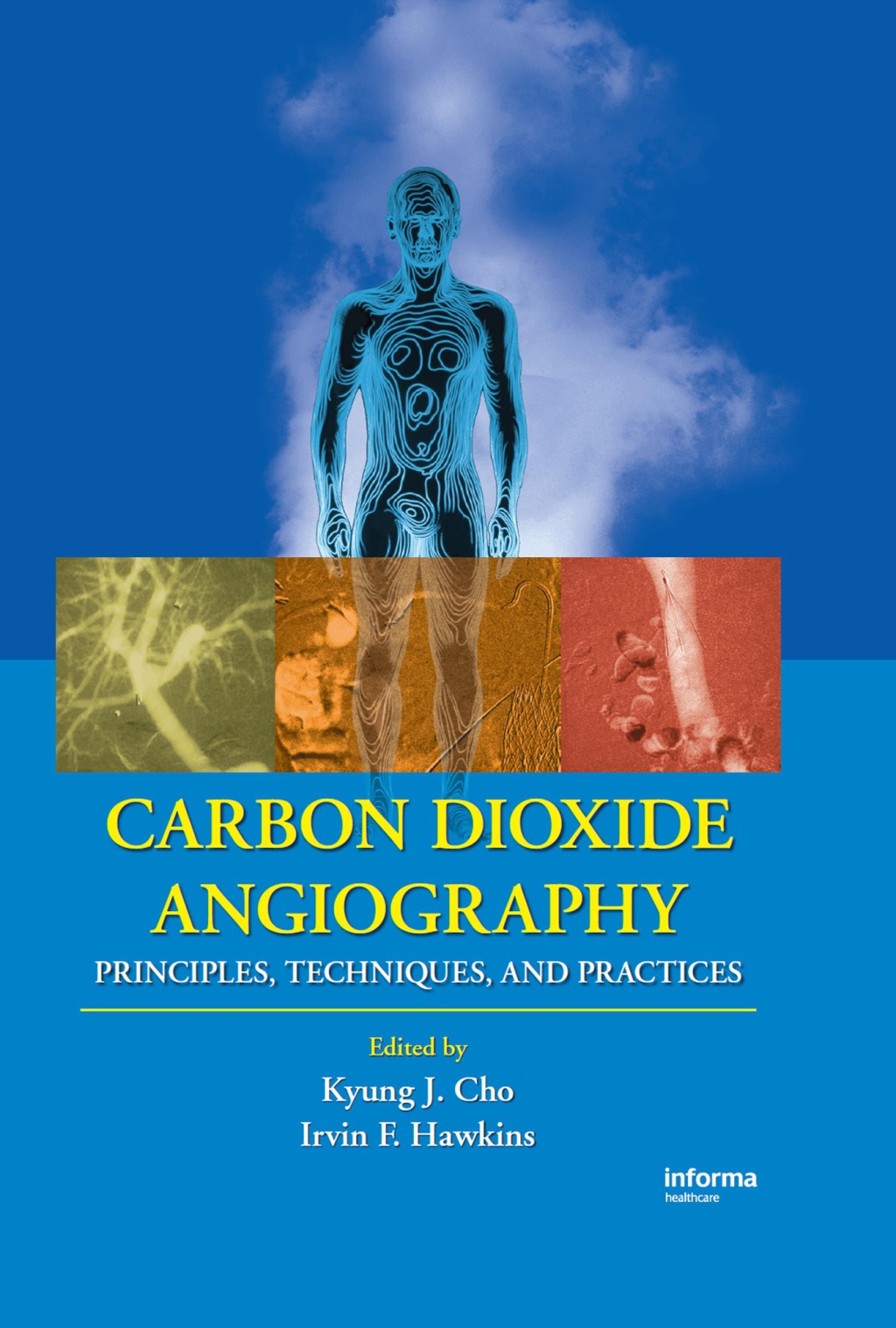 Carbon Dioxide Angiography Principles, Techniques, and Practices 1st Edition â€“ PDF/EPUB Version Downloadable