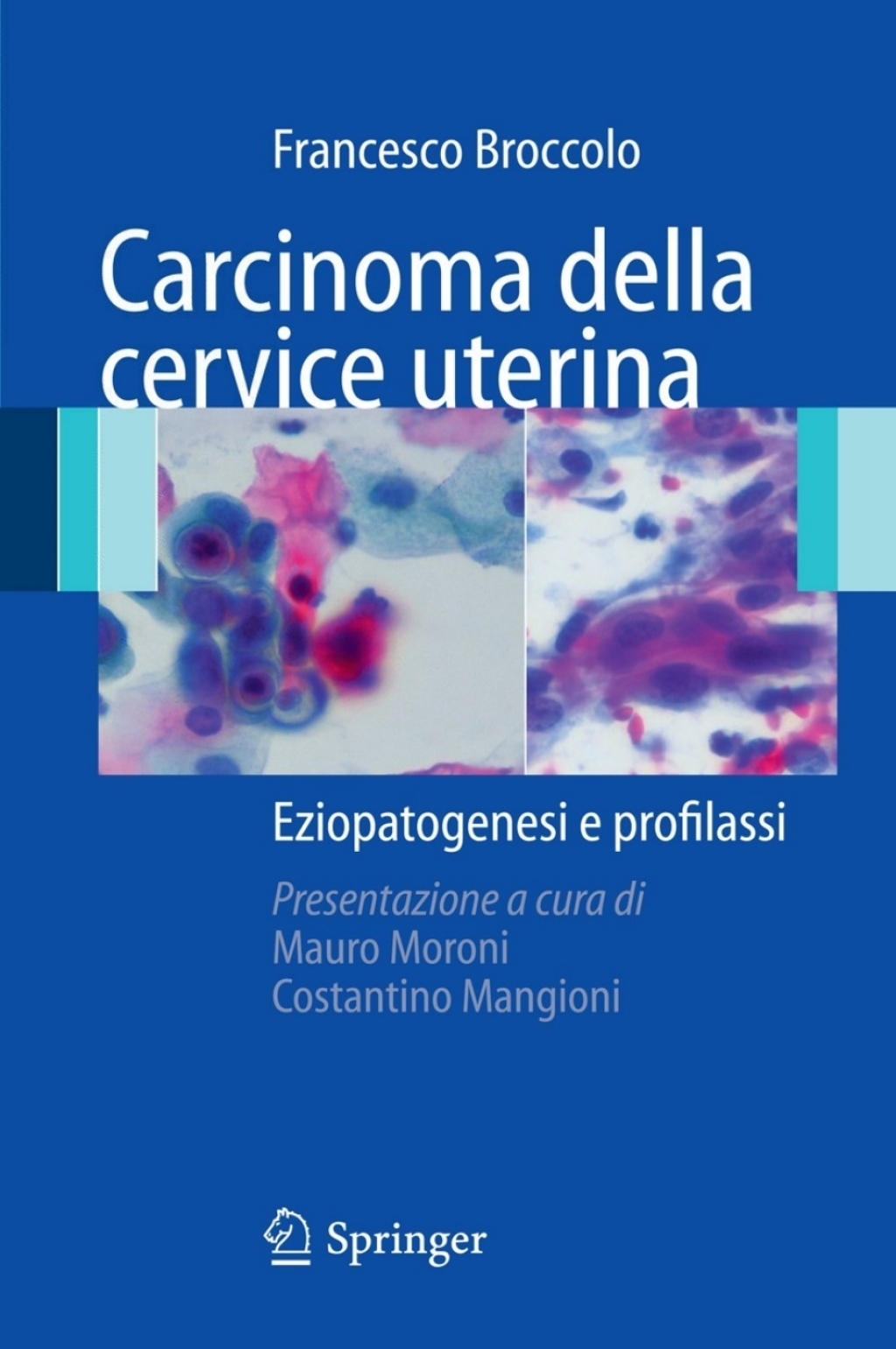 Carcinoma della cervice uterina Eziopatogenesi e profilassi - (PDF/EPUB Version)
