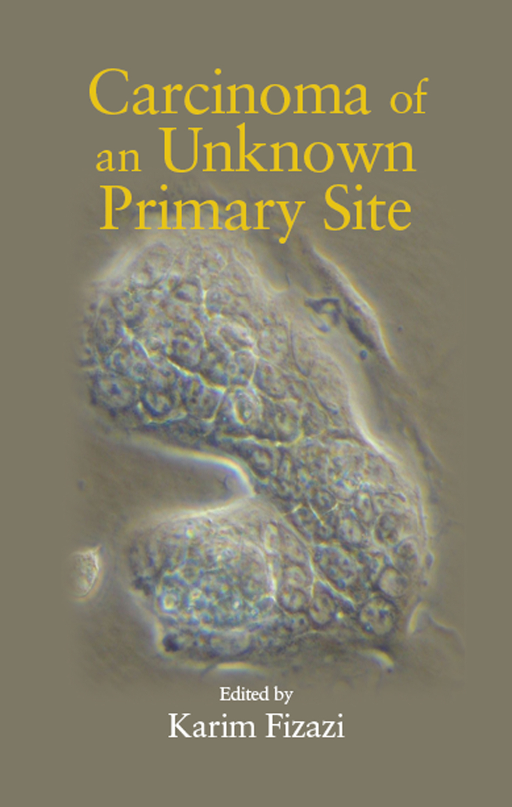 Carcinoma of an Unknown Primary Site 1st Edition â€“ PDF/EPUB Version Downloadable