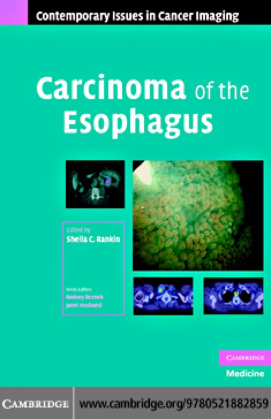 Carcinoma of the Esophagus 1st Edition â€“ PDF/EPUB Version ...