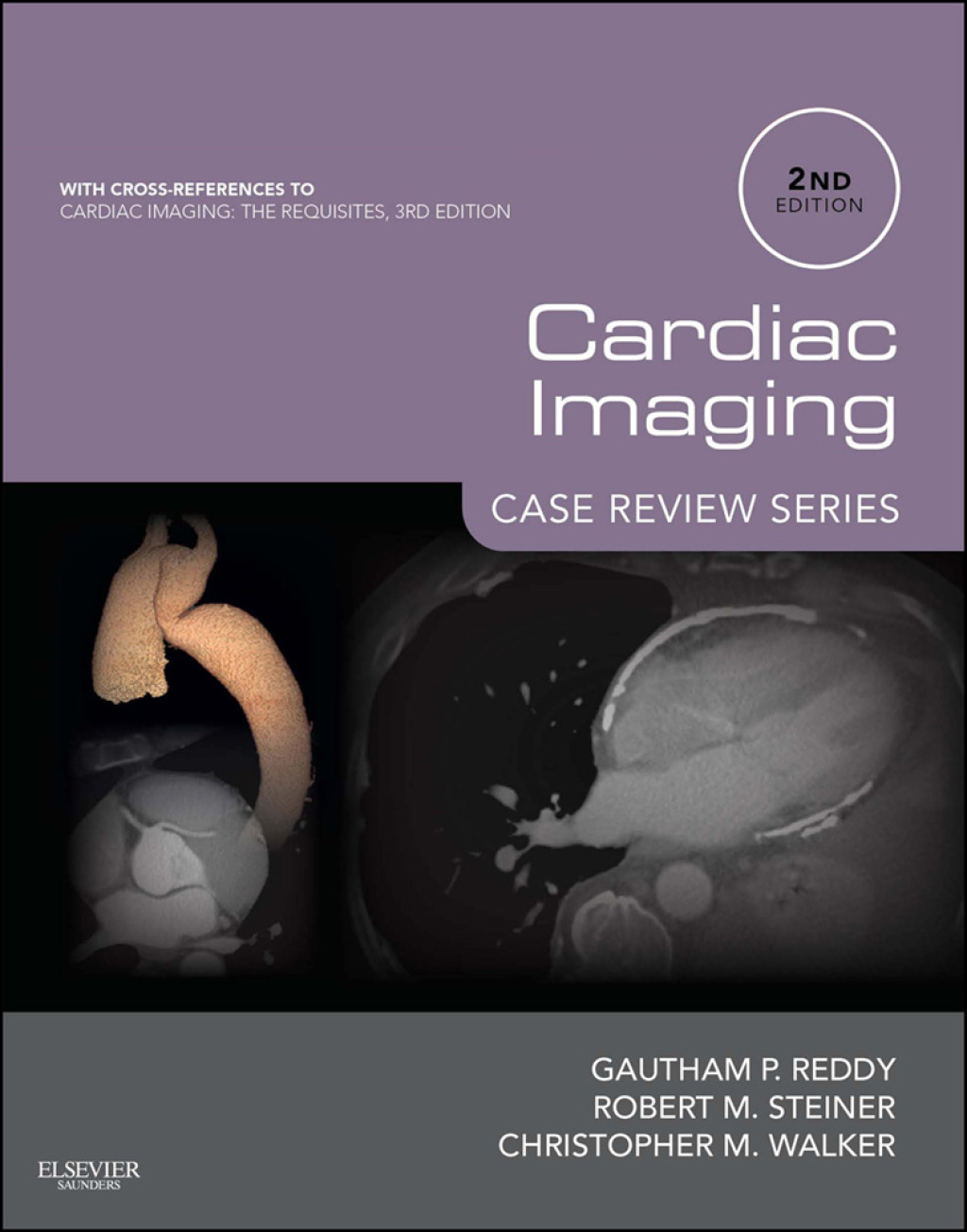 Cardiac Imaging: Case Review Series 2nd Edition â€“ PDF/EPUB Version Downloadable
