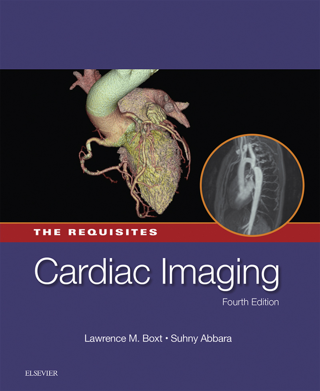 Cardiac Imaging: The Requisites 4th Edition â€“ PDF/EPUB Version Downloadable
