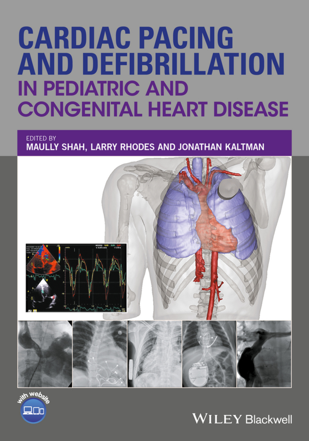 Cardiac Pacing and Defibrillation in Pediatric and Congenital Heart Disease 1st Edition â€“ PDF/EPUB Version Downloadable
