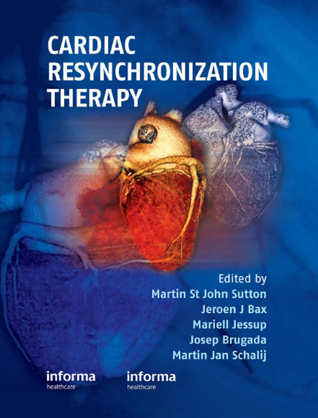 Cardiac Resynchronization Therapy 1st Edition – PDF/EPUB Version Downloadable Cardiac Resynchronization Therapy 1st Edition – PDF/EPUB Version Downloadable - Image 1