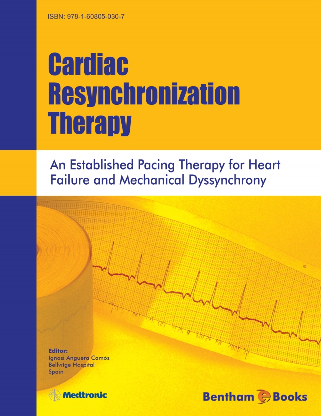 Cardiac Resynchronization Therapy: An Established Pacing Therapy For Heart Failure And Mechanical Dyssynchrony 1st Edition - (PDF/EPUB Version)