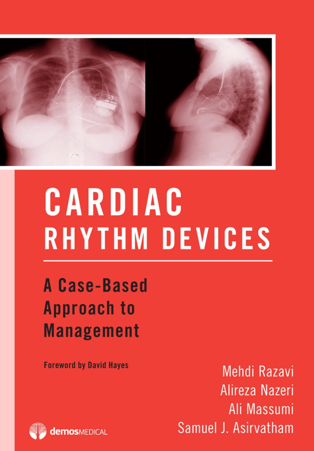 Cardiac Rhythm Devices A Case-Based Approach to Management 1st Edition â€“ PDF/EPUB Version Downloadable