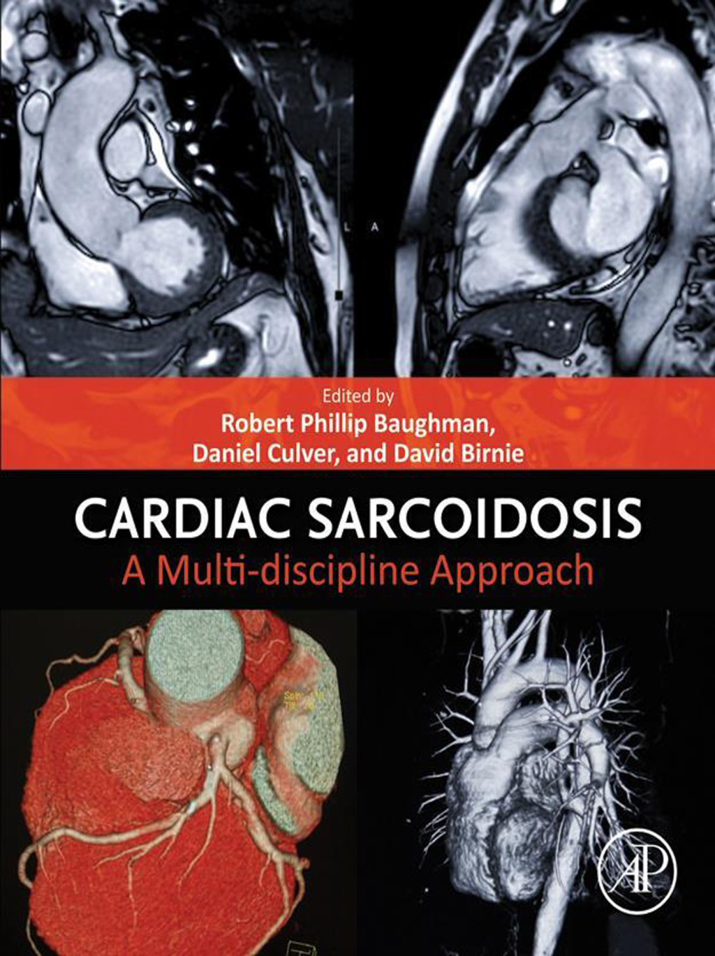 Cardiac Sarcoidosis A Multi-discipline Approach â€“ PDF/EPUB Version Downloadable