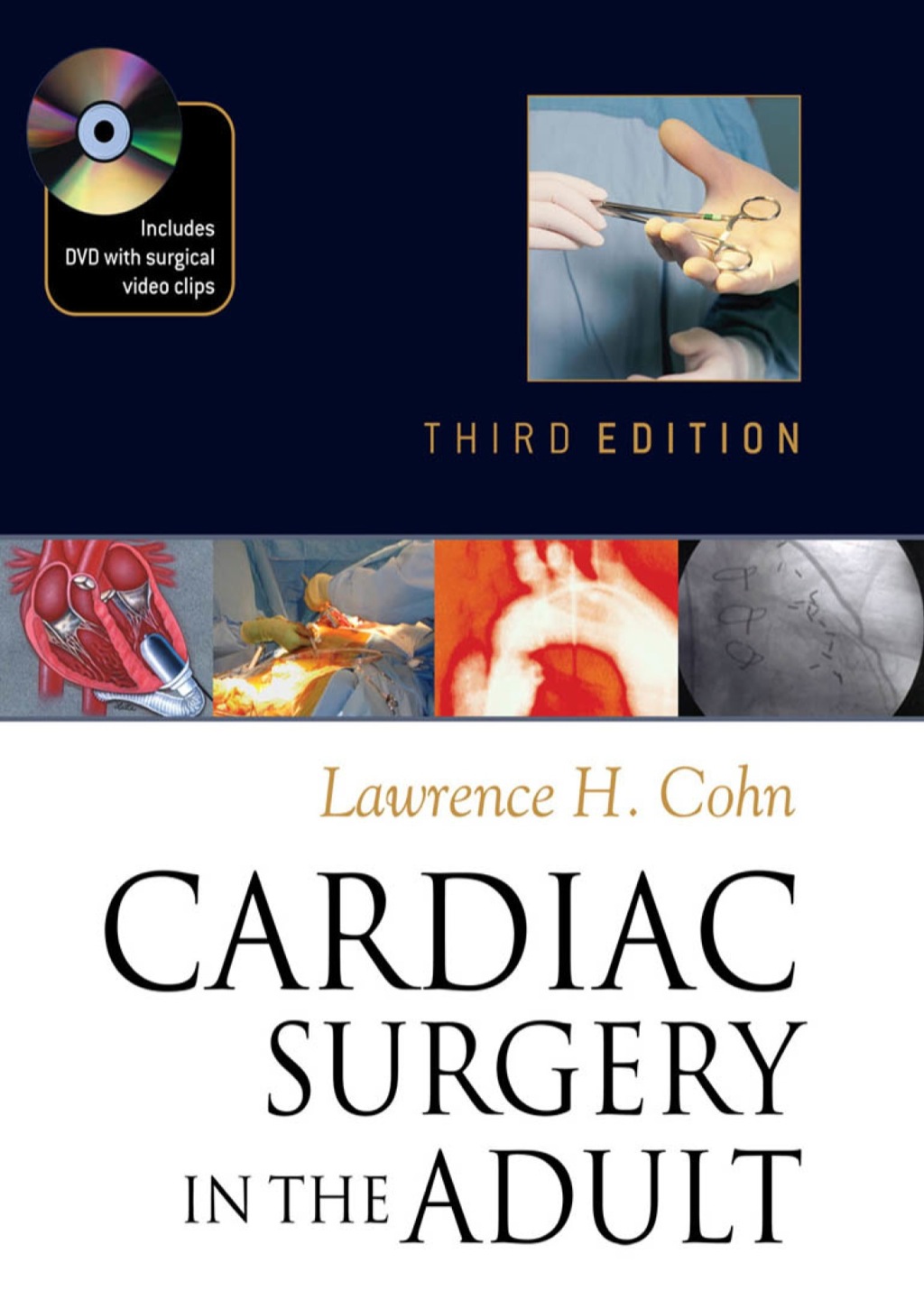 Cardiac Surgery in the Adult 3rd Edition â€“ PDF/EPUB Version Downloadable