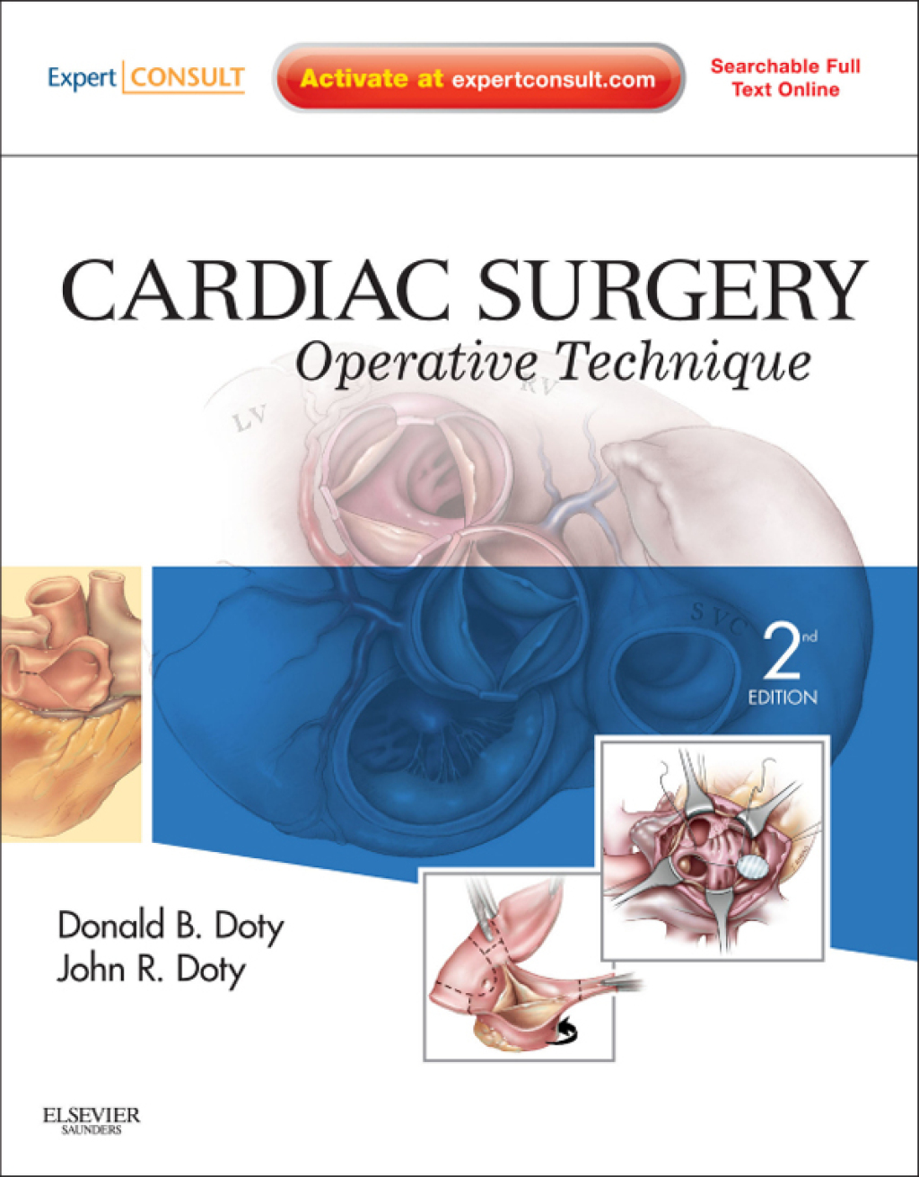 Cardiac Surgery Operative Technique 3rd Edition â€“ PDF/EPUB Version Downloadable