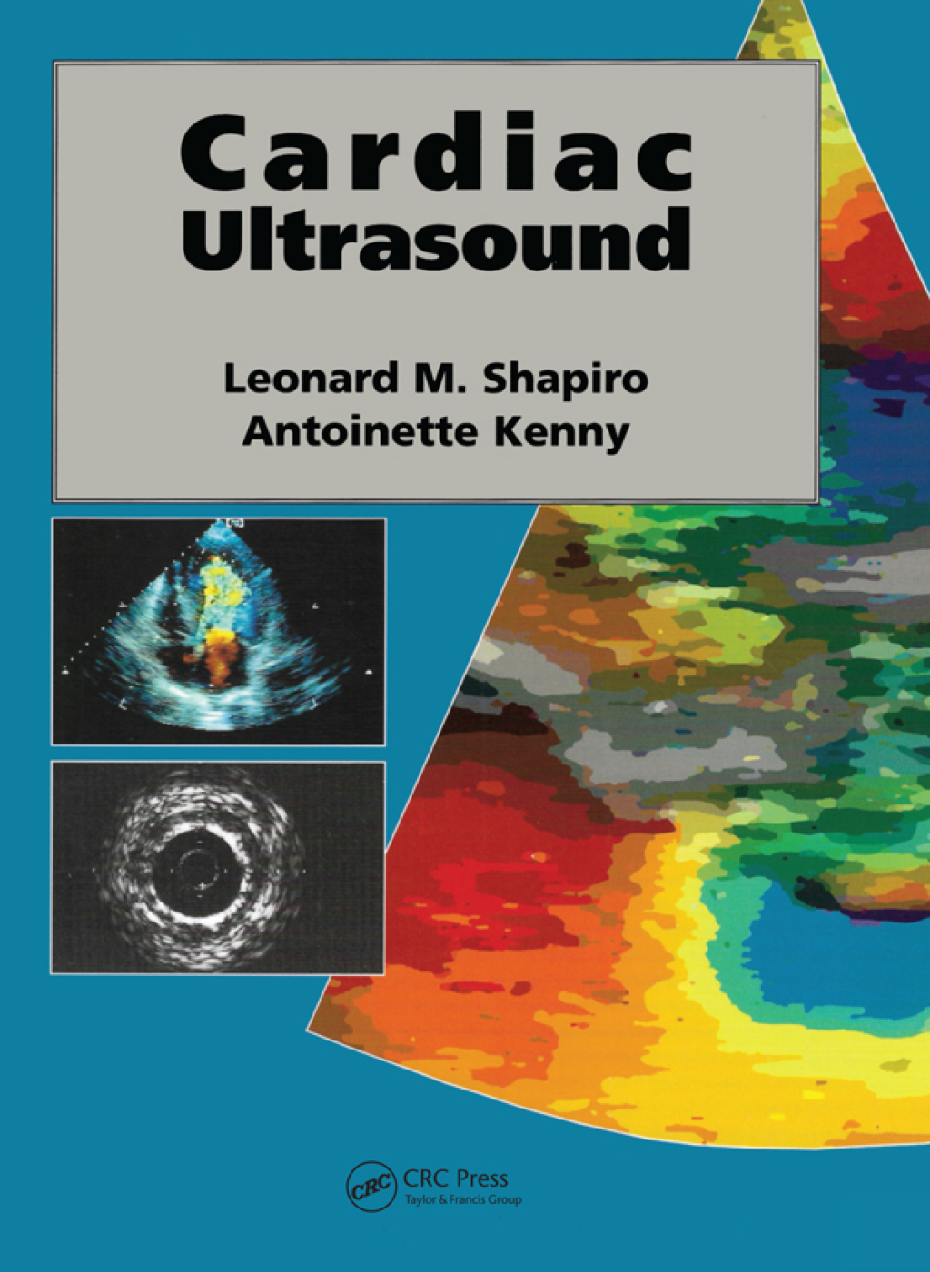 Cardiac Ultrasound 1st Edition â€“ PDF/EPUB Version Downloadable