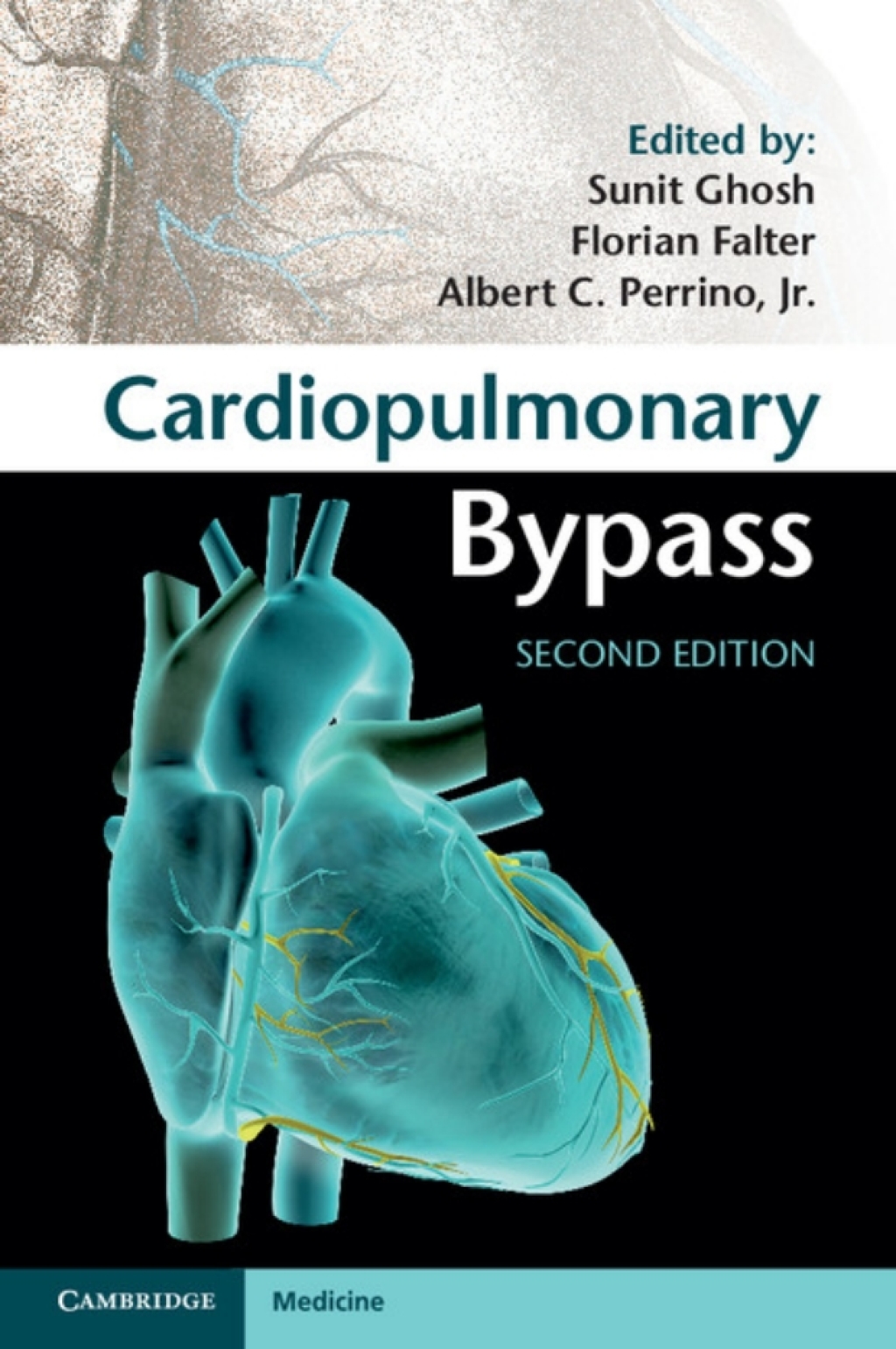 Cardiopulmonary Bypass 2nd Edition â€“ PDF/EPUB Version Downloadable
