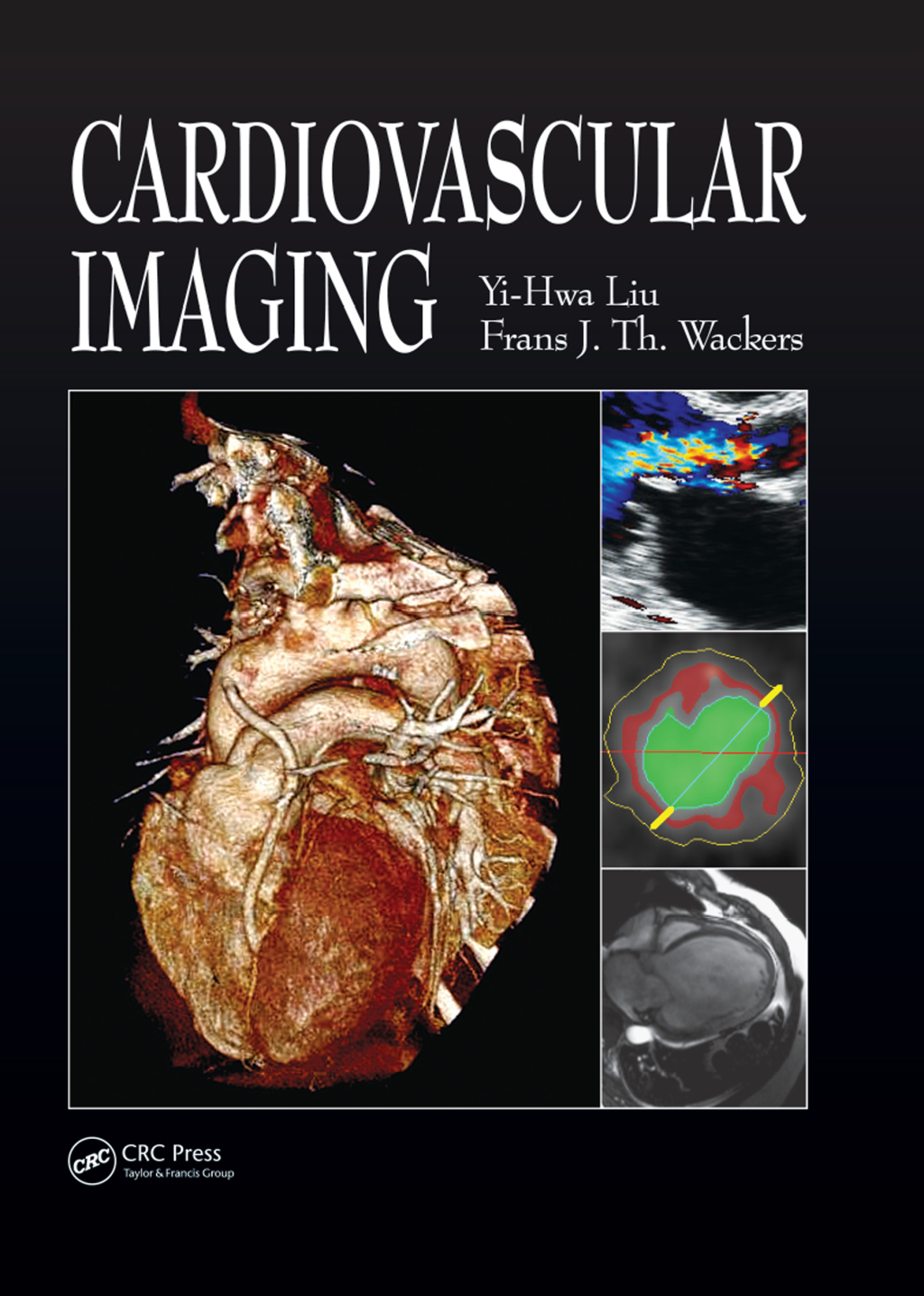 Cardiovascular Imaging 1st Edition â€“ PDF/EPUB Version Downloadable