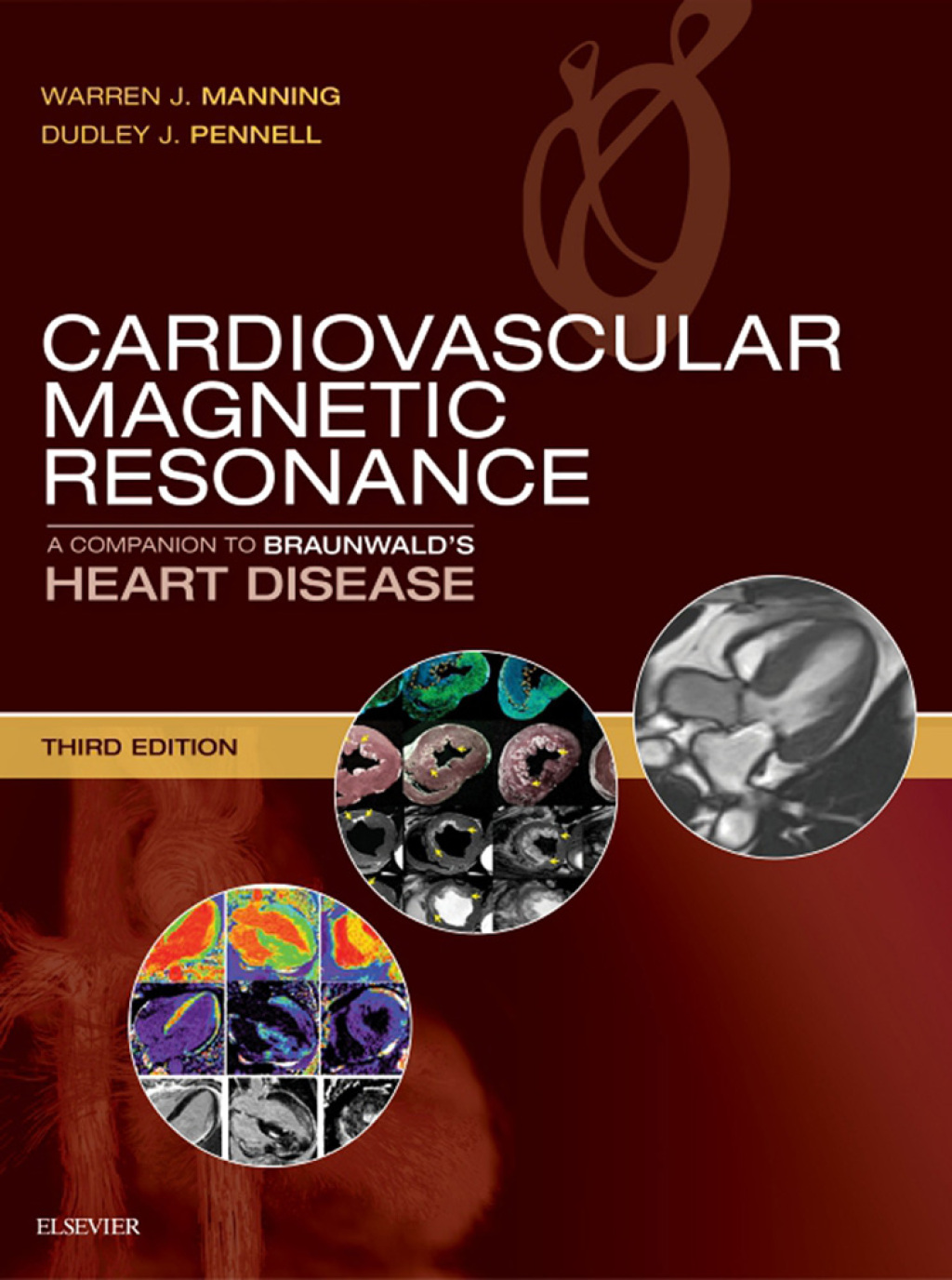 Cardiovascular Magnetic Resonance A Companion to Braunwaldâ€™s Heart Disease 3rd Edition â€“ PDF/EPUB Version Downloadable