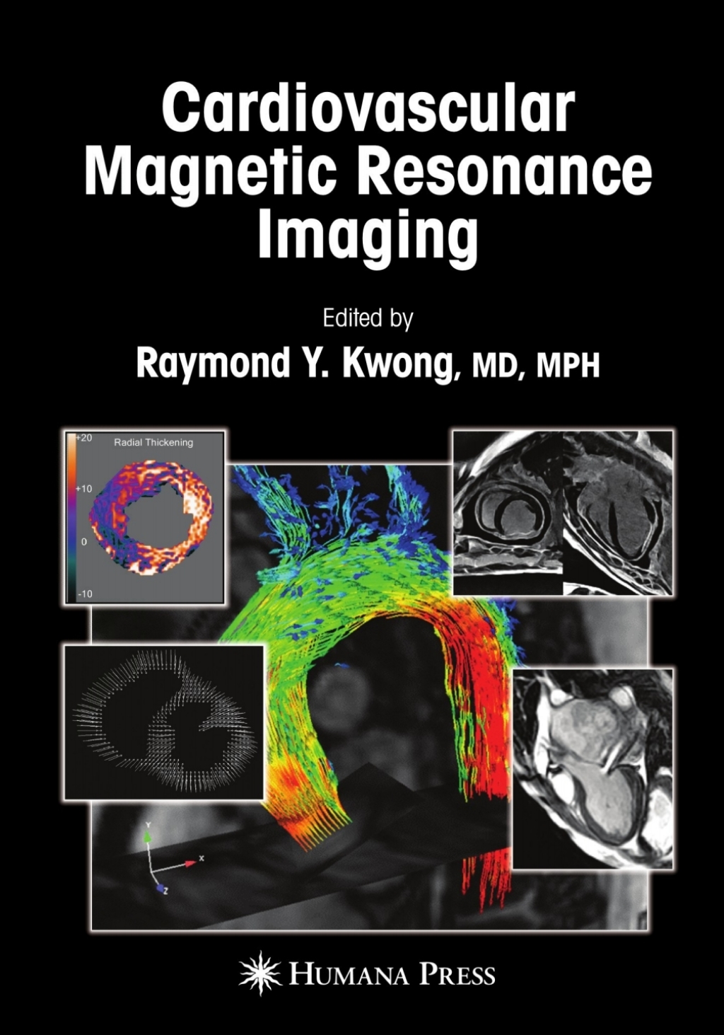 Cardiovascular Magnetic Resonance Imaging 1st Edition â€“ PDF/EPUB Version Downloadable
