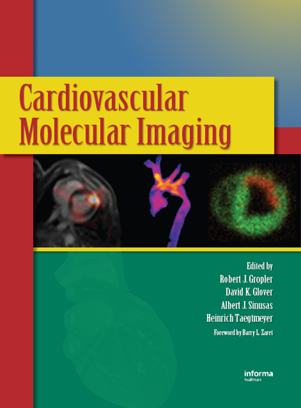 Cardiovascular Molecular Imaging 1st Edition â€“ PDF/EPUB Version Downloadable