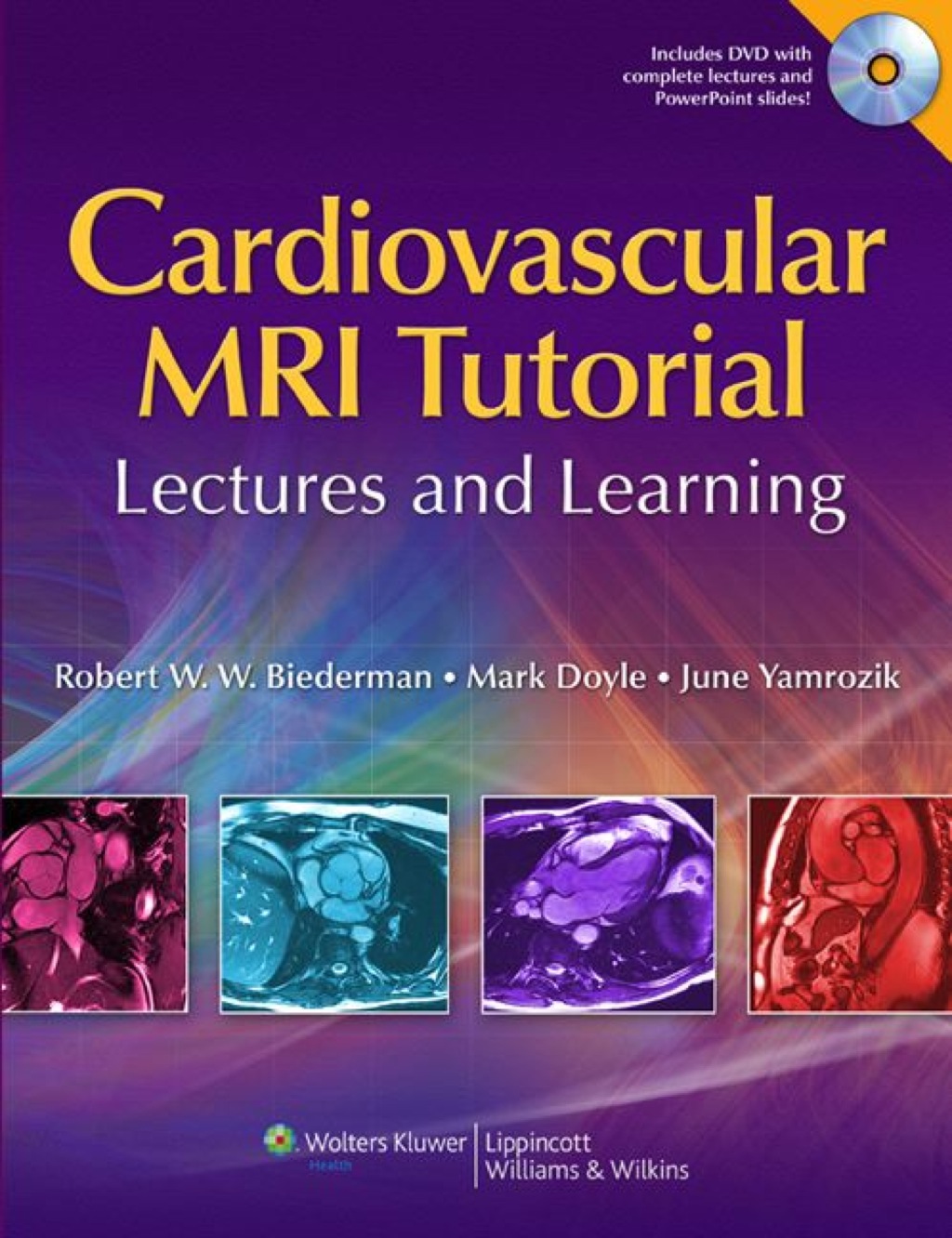 Cardiovascular MRI Tutorial: Lectures and Learning 1st Edition â€“ PDF/EPUB Version Downloadable
