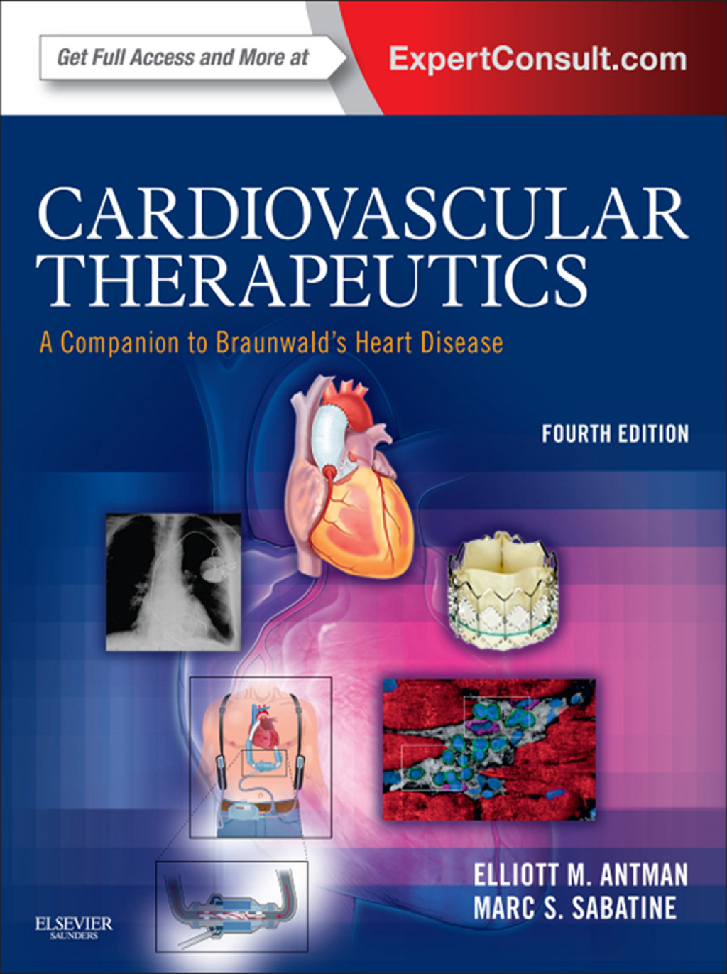 Cardiovascular Therapeutics 4th Edition â€“ PDF/EPUB Version Downloadable