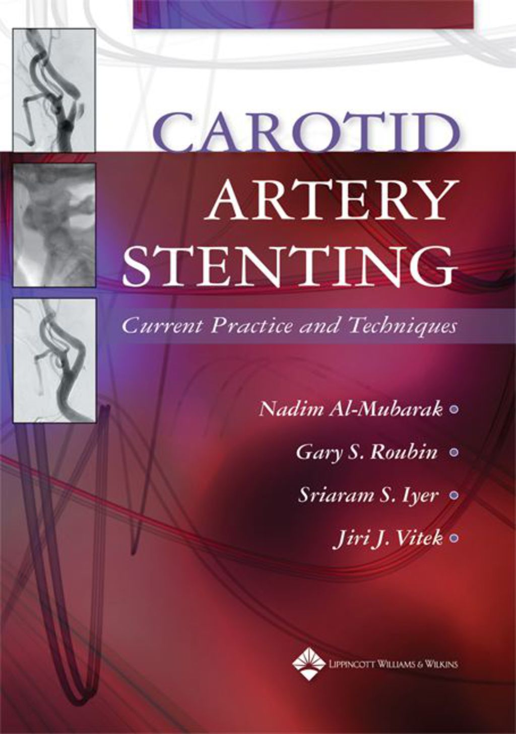 Carotid Artery Stenting: Current Practice and Techniques 1st Edition â€“ PDF/EPUB Version Downloadable