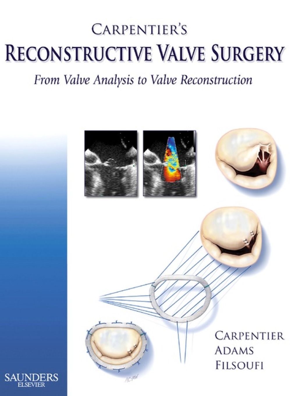 Carpentier's Reconstructive Valve Surgery â€“ PDF/EPUB Version Downloadable