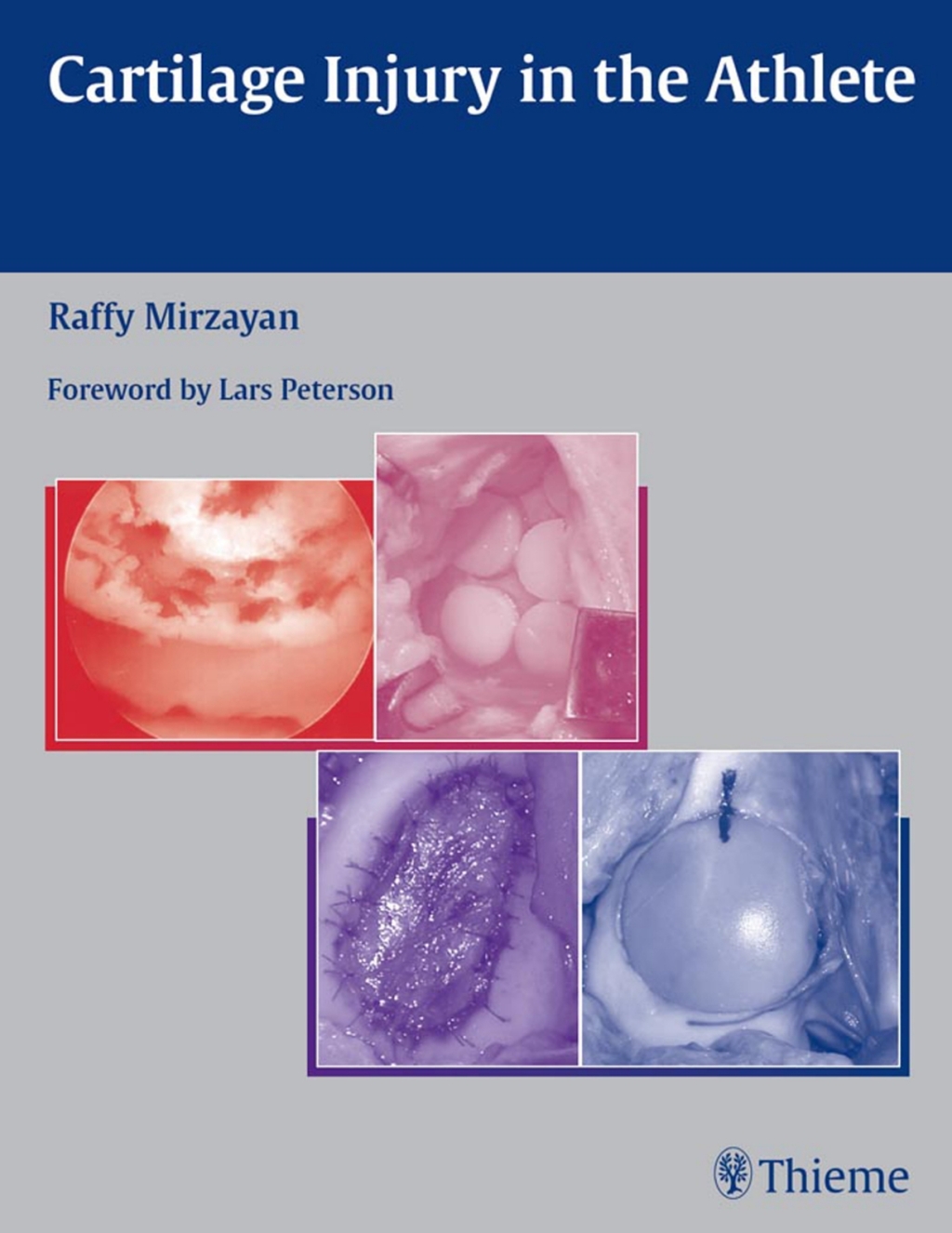Cartilage Injury in the Athlete 1st Edition â€“ PDF/EPUB Version Downloadable
