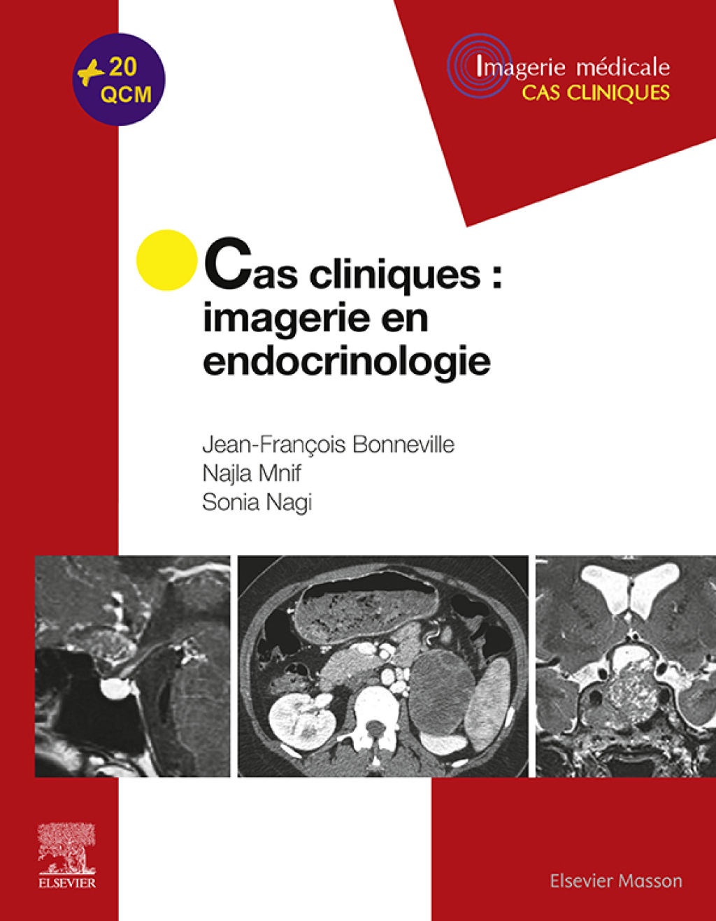 Cas cliniques en imagerie : endocrinologie  â€“ PDF/EPUB Version Downloadable