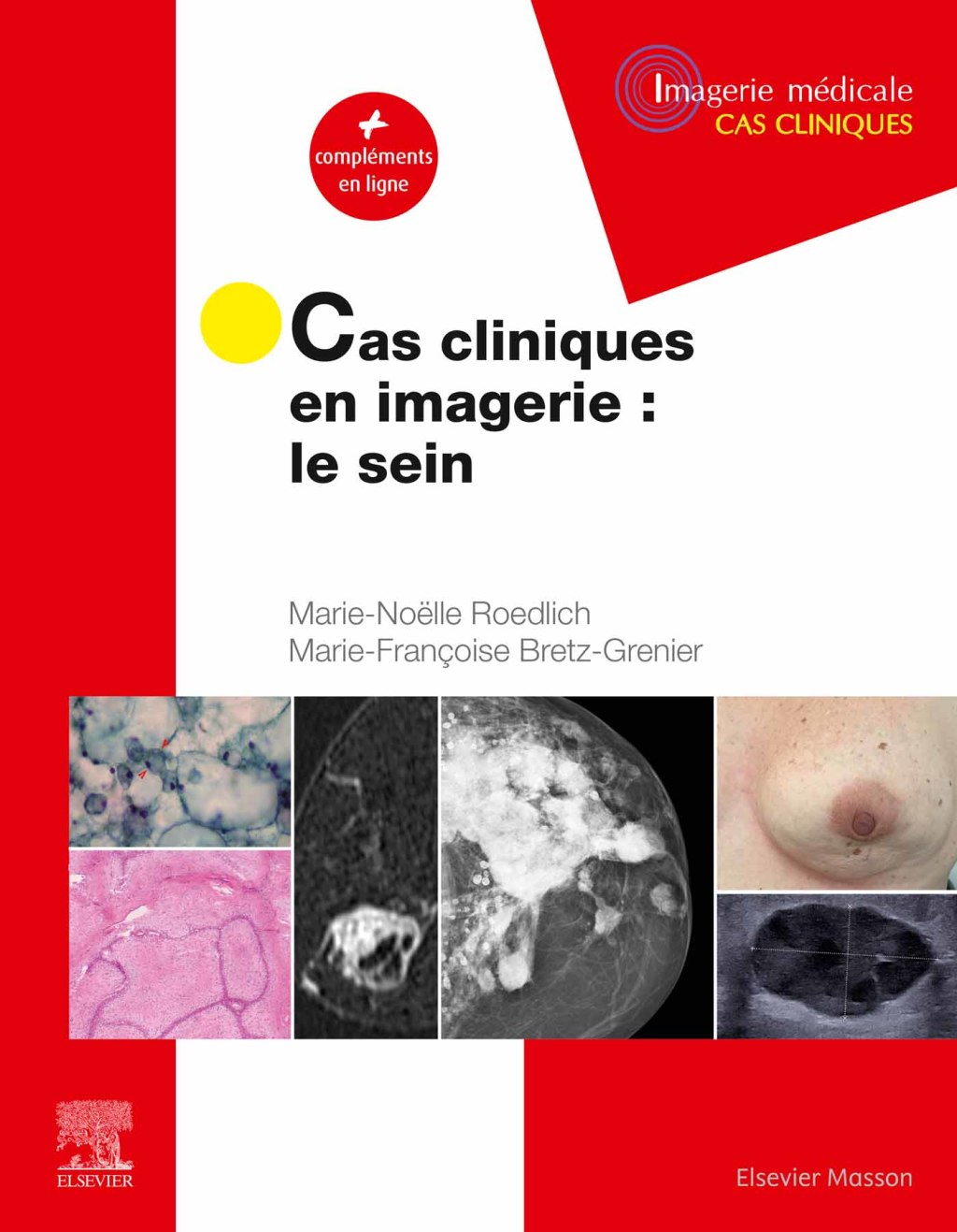 Cas cliniques en imagerie : le sein  â€“ PDF/EPUB Version Downloadable