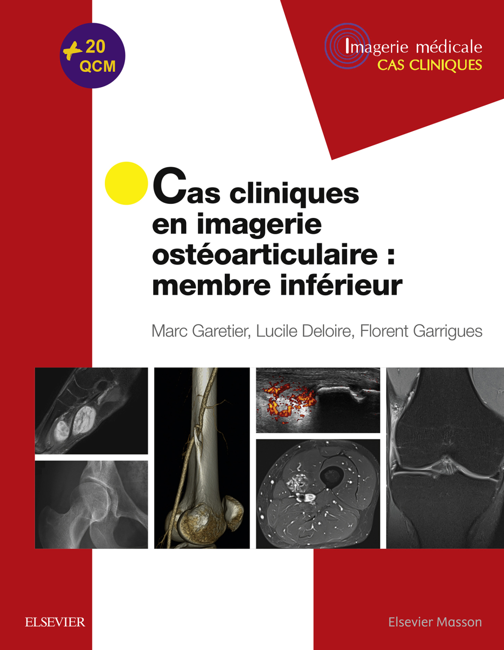 Cas cliniques en imagerie ostÃ©oarticulaire : membre infÃ©rieur  â€“ PDF/EPUB Version Downloadable