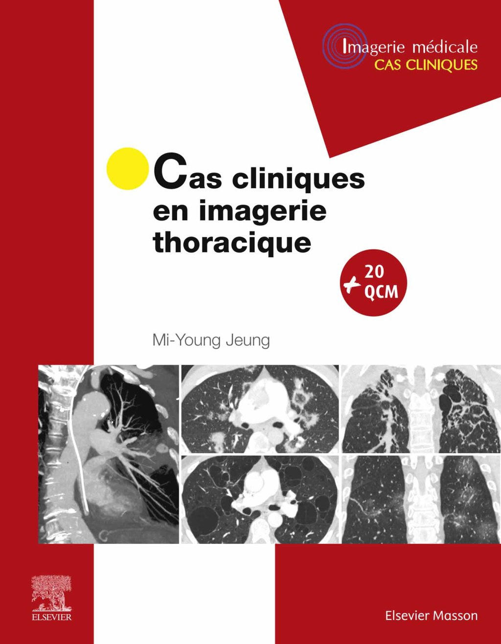 Cas cliniques en imagerie thoracique  â€“ PDF/EPUB Version Downloadable
