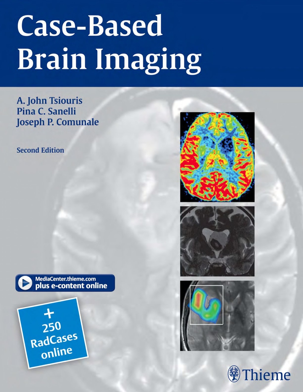 Case-Based Brain Imaging 2nd Edition â€“ PDF/EPUB Version Downloadable