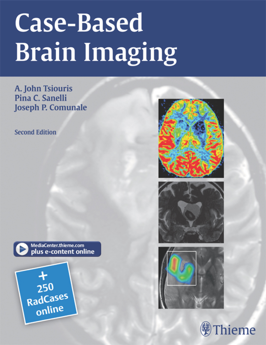 Case-Based Brain Imaging 2nd Edition â€“ PDF/EPUB Version Downloadable