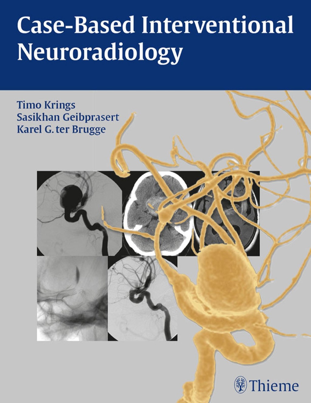 Case-Based Interventional Neuroradiology 1st Edition â€“ PDF/EPUB Version Downloadable