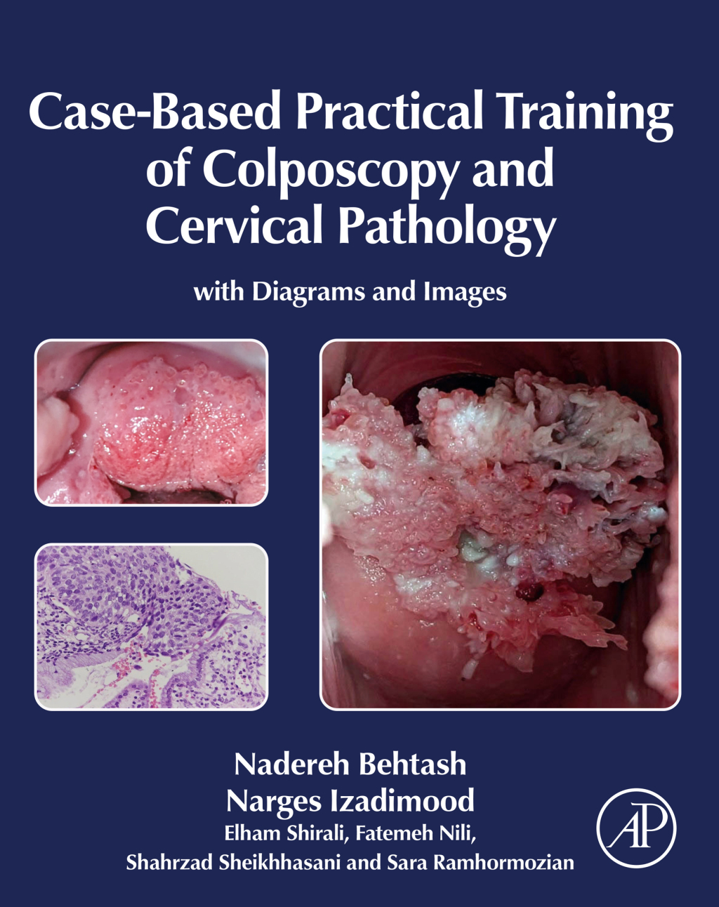 Case-Based Practical Training of Colposcopy and Cervical Pathology With Diagrams and Images 1st Edition â€“ PDF/EPUB Version Downloadable