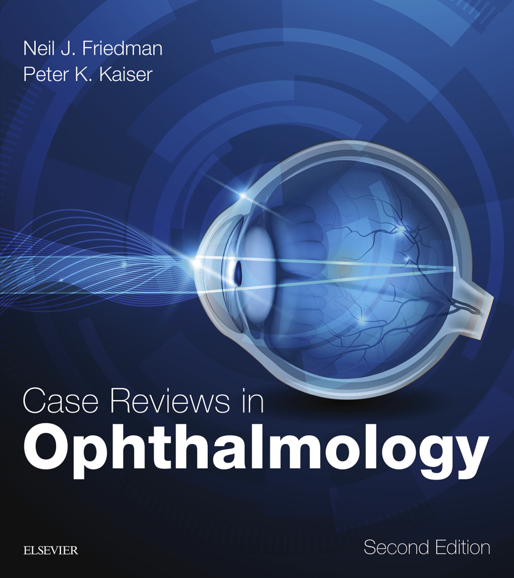 Case Reviews in Ophthalmology 2nd Edition â€“ PDF/EPUB Version Downloadable