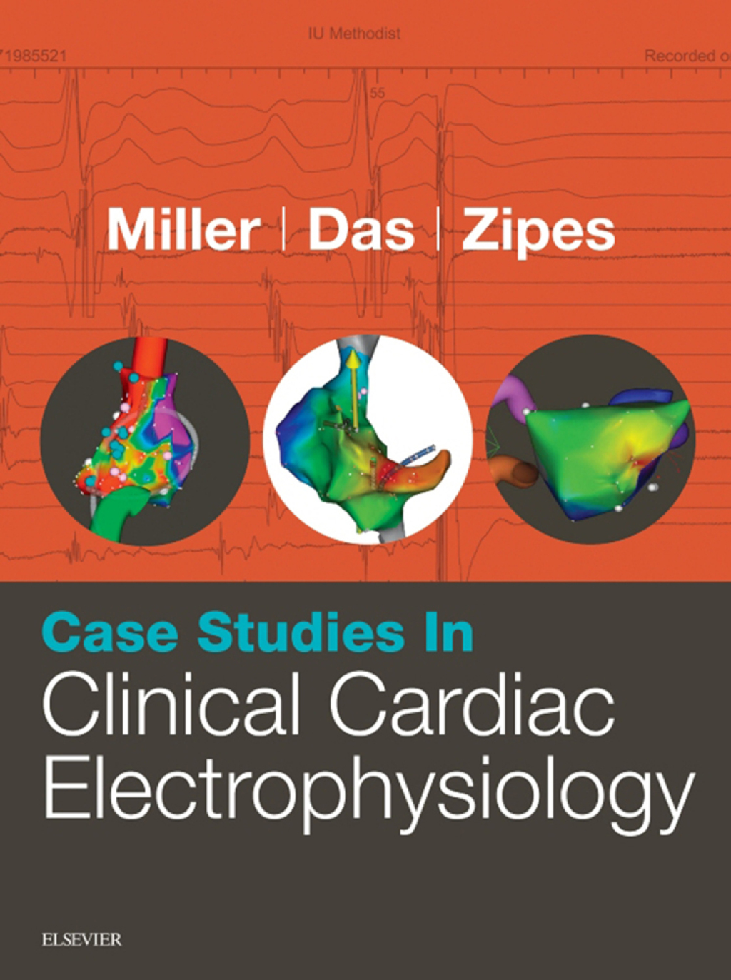 Case Studies in Clinical Cardiac Electrophysiology â€“ PDF/EPUB Version Downloadable