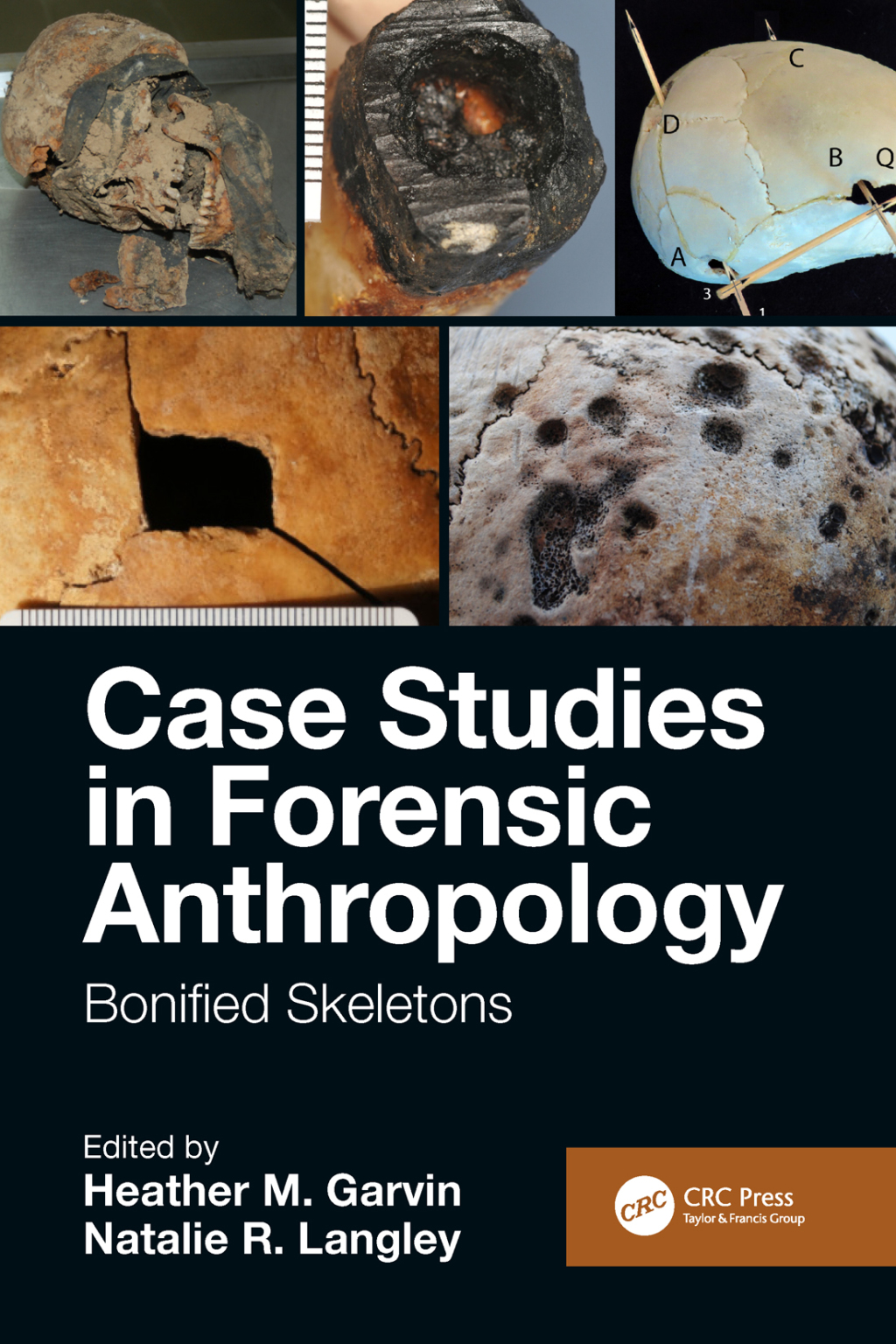 Case Studies in Forensic Anthropology Bonified Skeletons 1st Edition â€“ PDF/EPUB Version Downloadable