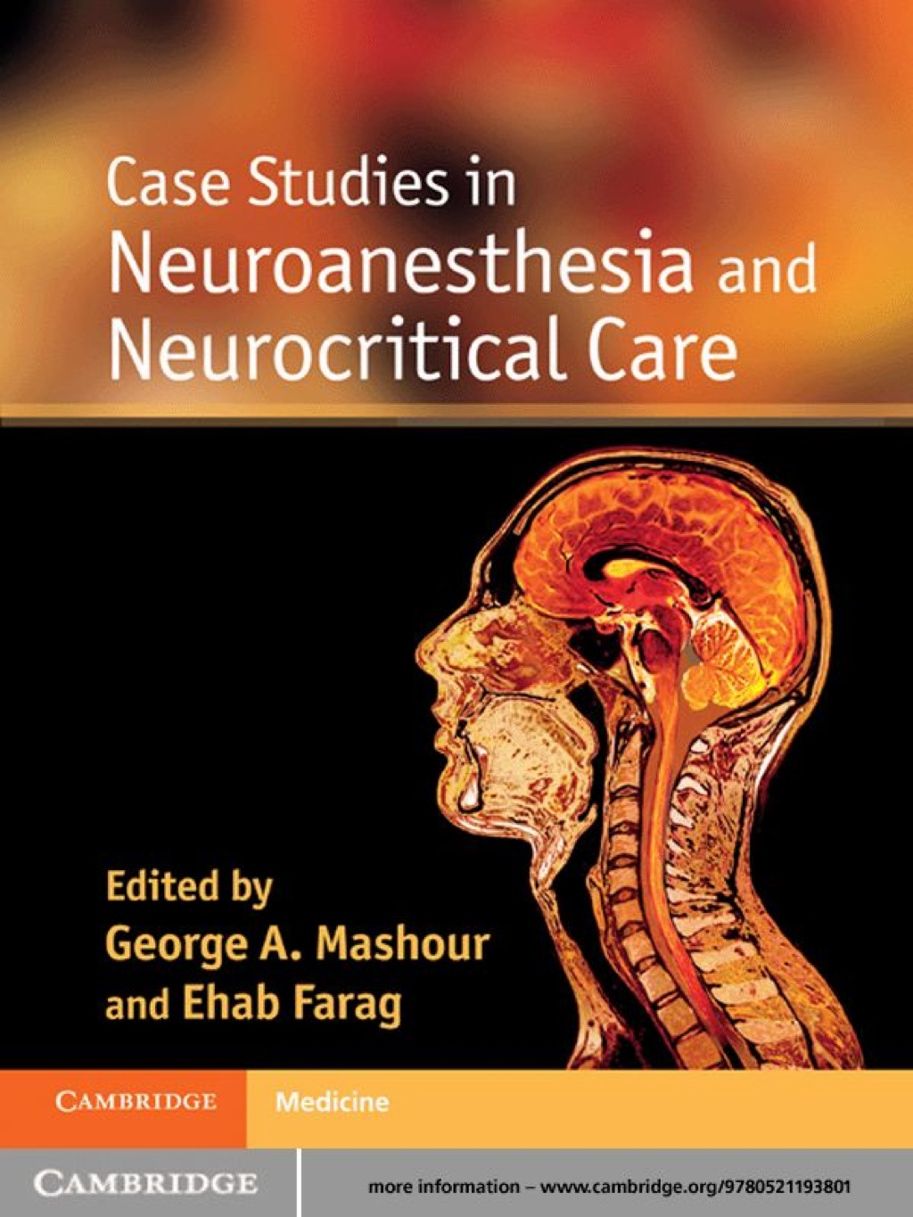 Case Studies in Neuroanesthesia and Neurocritical Care 1st Edition â€“ PDF/EPUB Version Downloadable